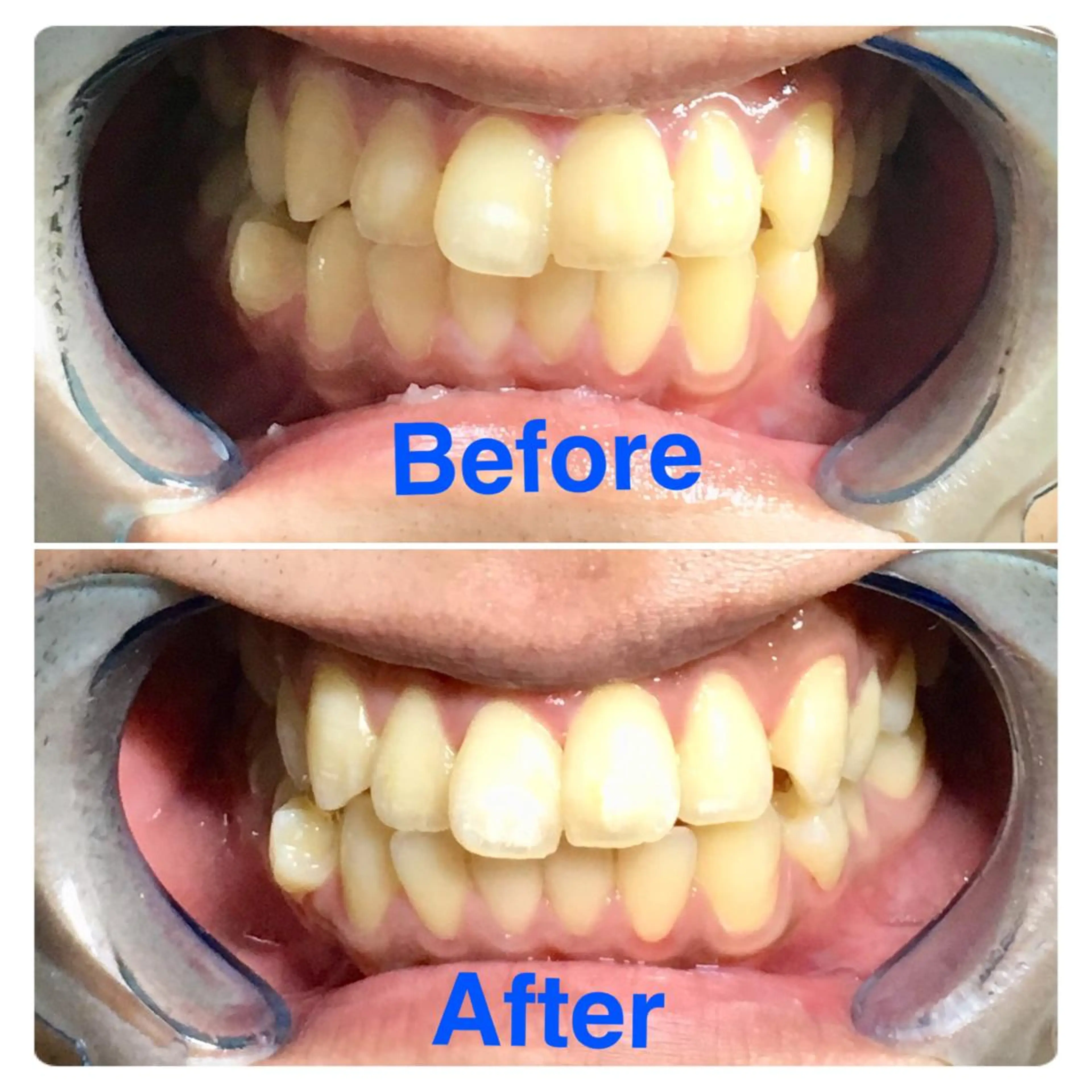 イーチブライト EachBrightのその他イメージ