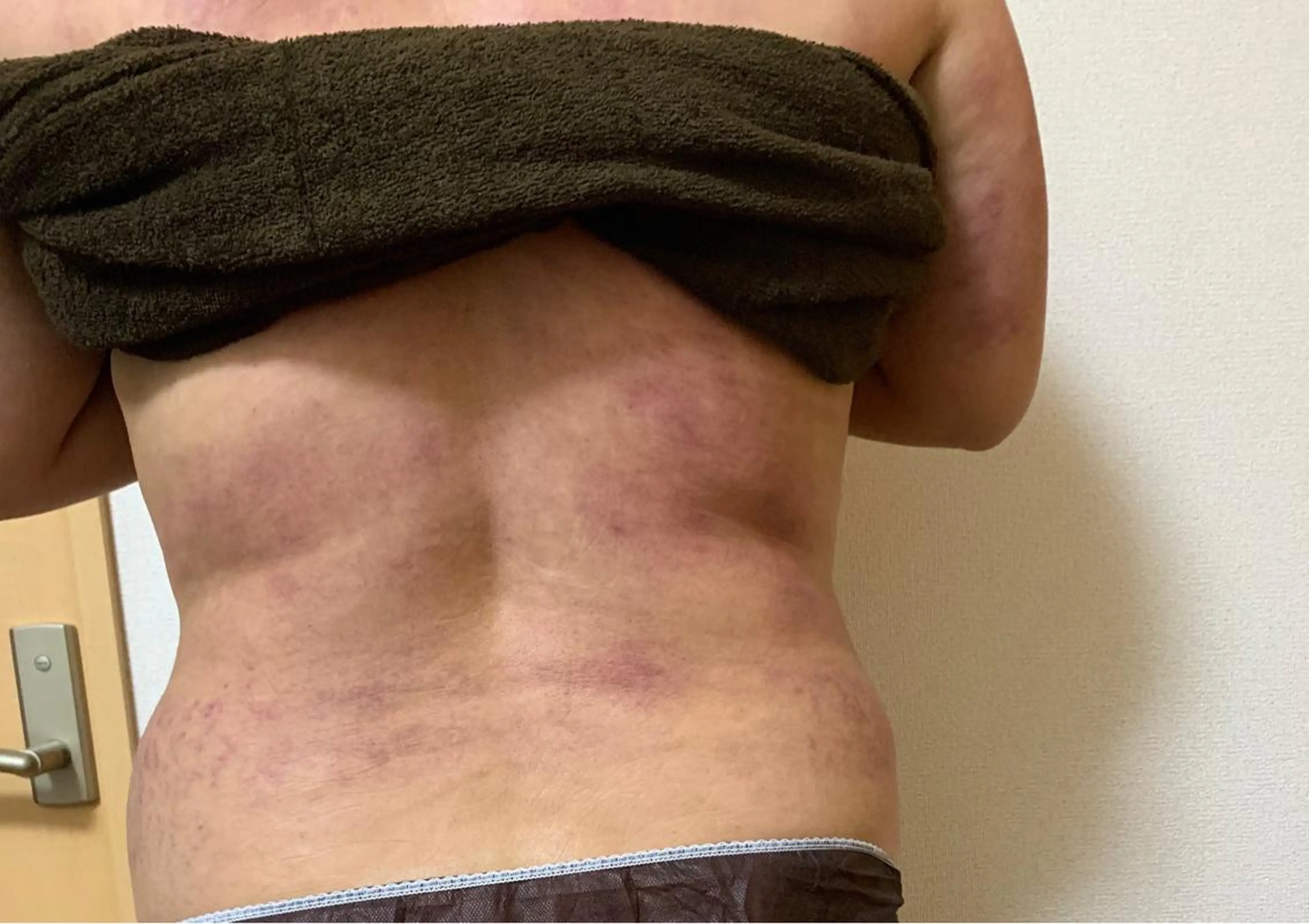 エステ リラク 痩身/脱毛/ネイル HARUKAのエステ・リラクイメージ