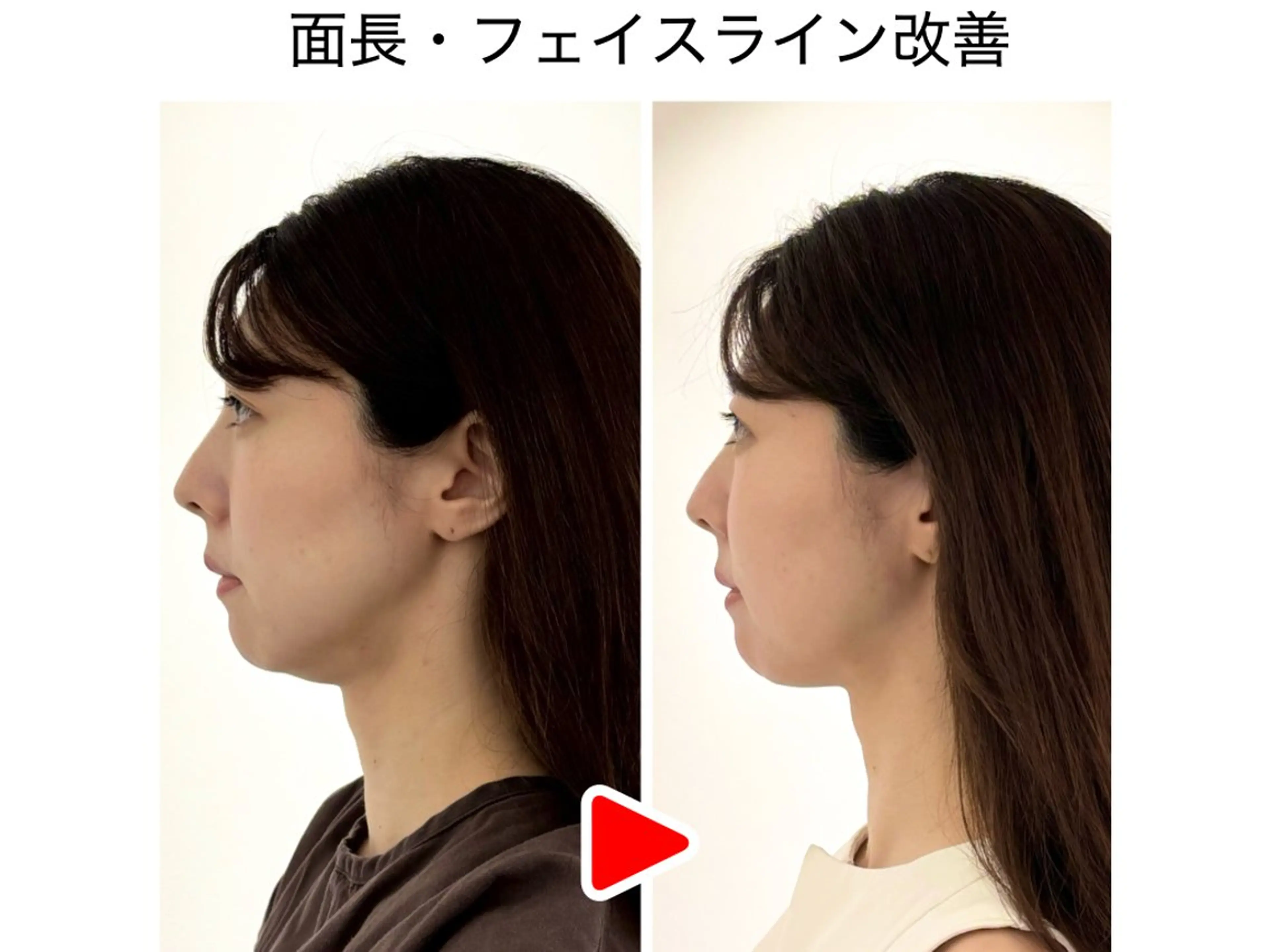 エステ リラク 小顔矯正 骨盤矯正 美容整体サロン ELVISA TOKYO 恵比寿院所属・古川 智也のエステ・リラクイメージ