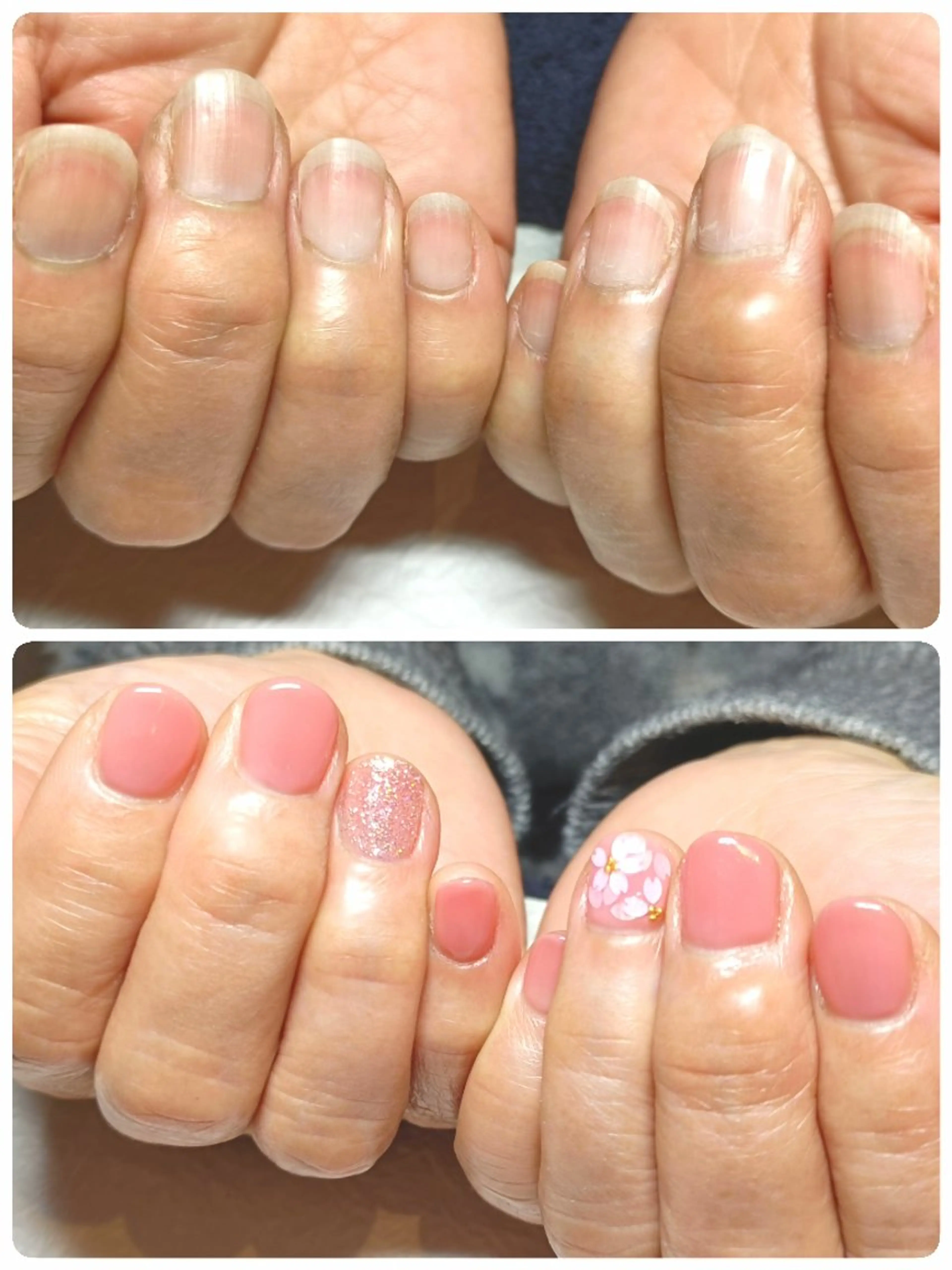 ネイル ジェルネイル 春ネイル ハンドネイル ハンドケア 深爪矯正/爪育成ケア manie nailのネイルデザイン