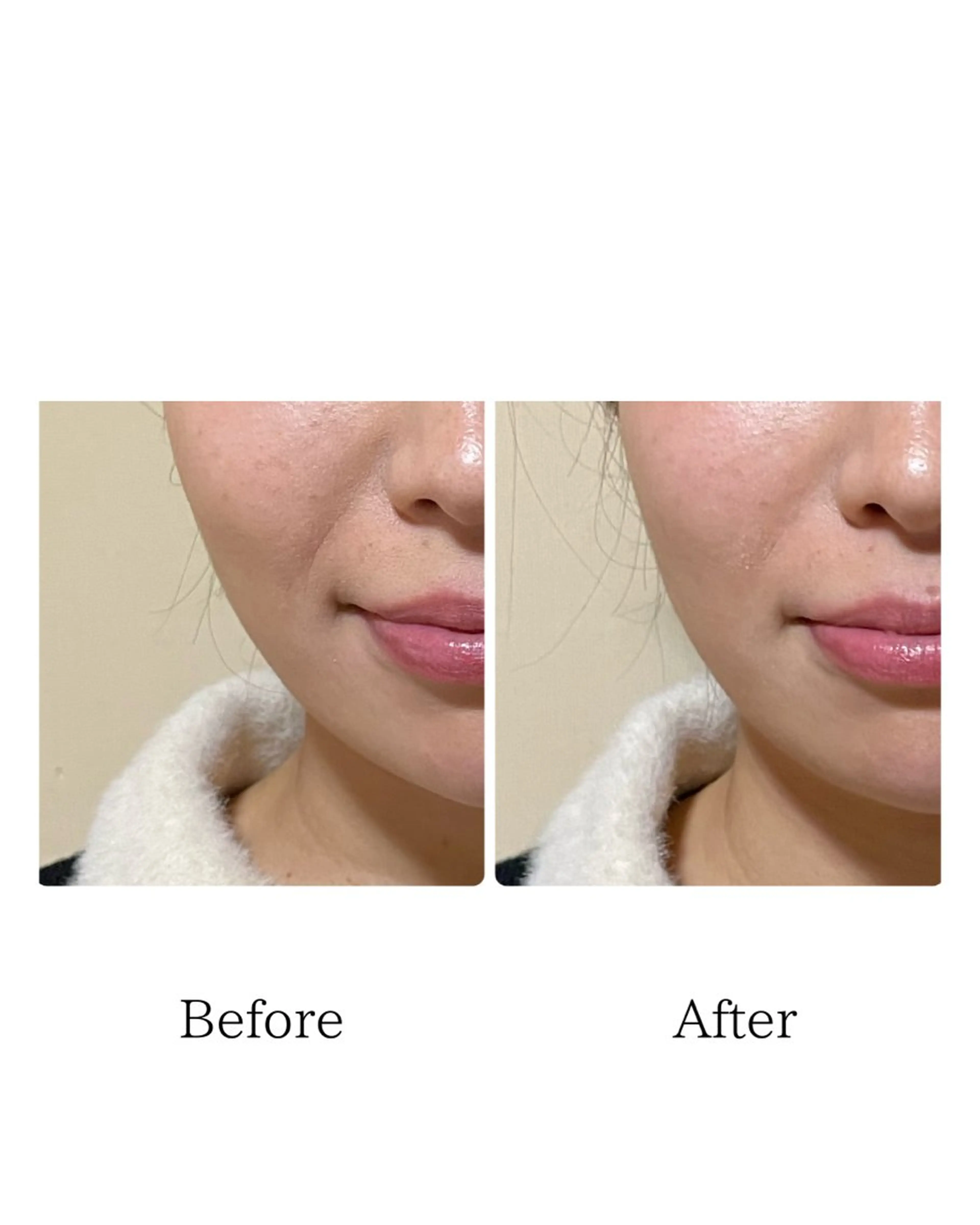 美容鍼灸サロン   colorier所属・美容鍼灸サロン colorierのエステ・リラクイメージ