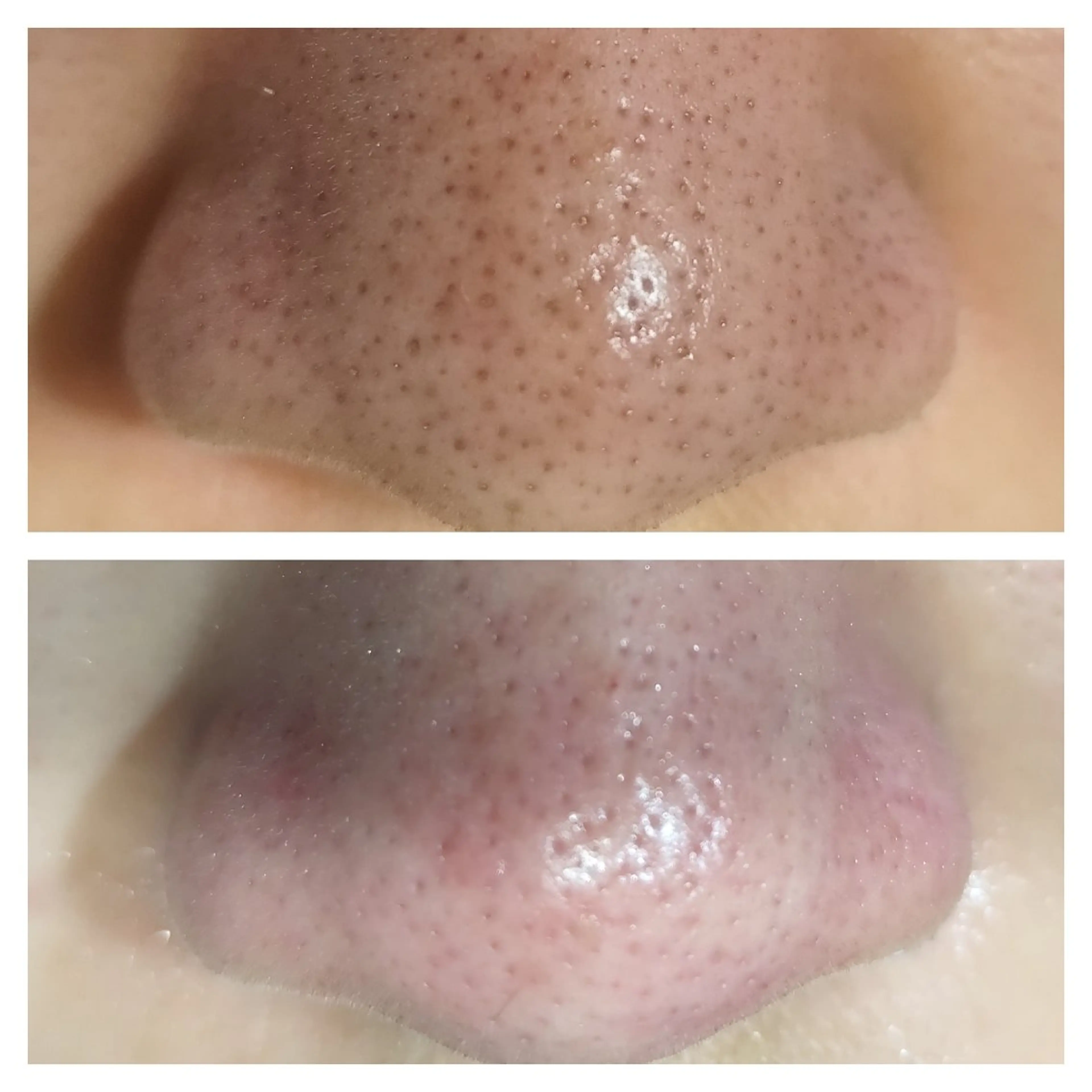 美肌脱毛サロン つるりと御殿場店所属・美肌脱毛サロン つるりとのその他イメージ