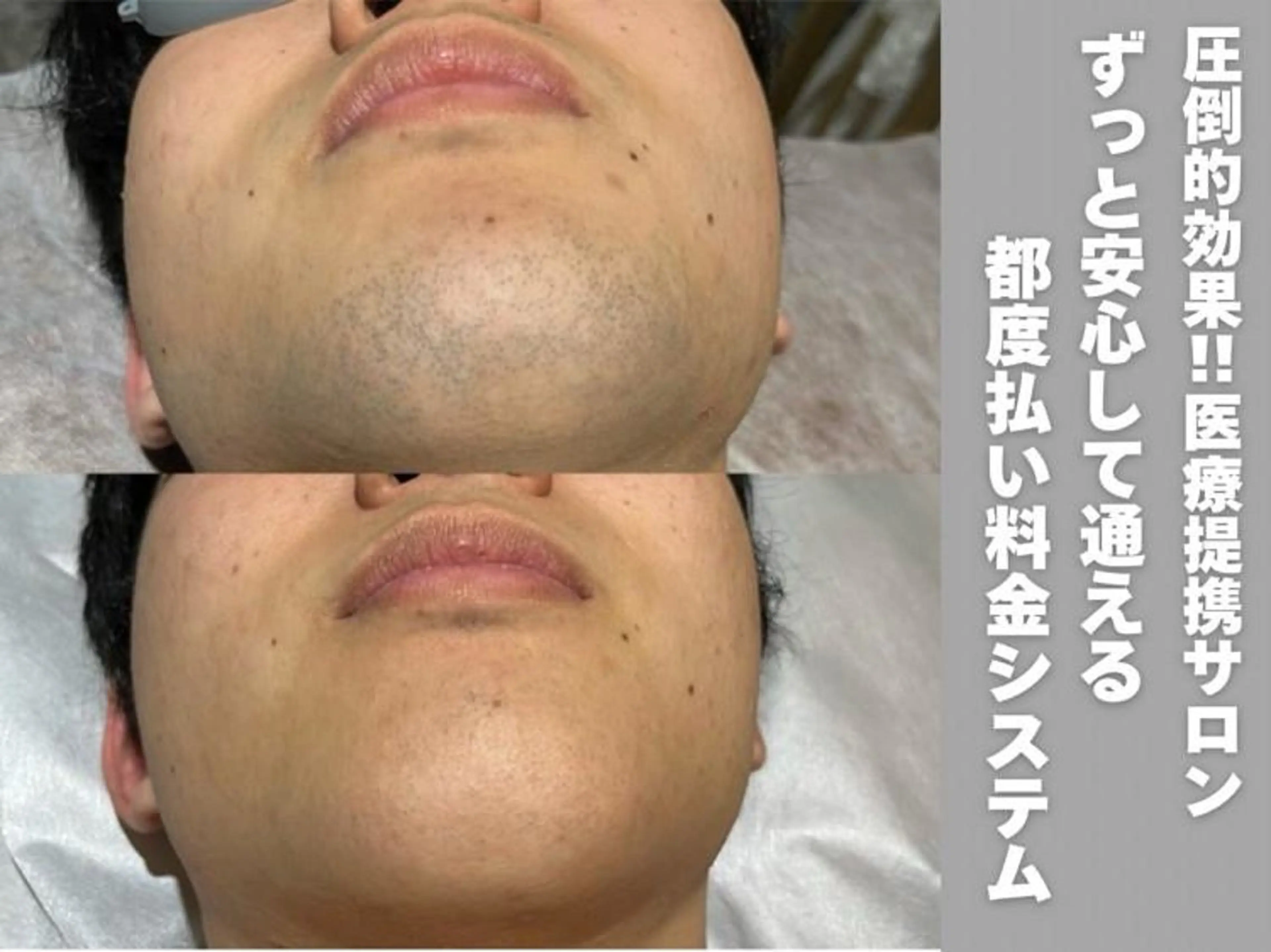 hanaCoco+plus所属・hanacoco ＋plusのマツエク・マツパデザイン