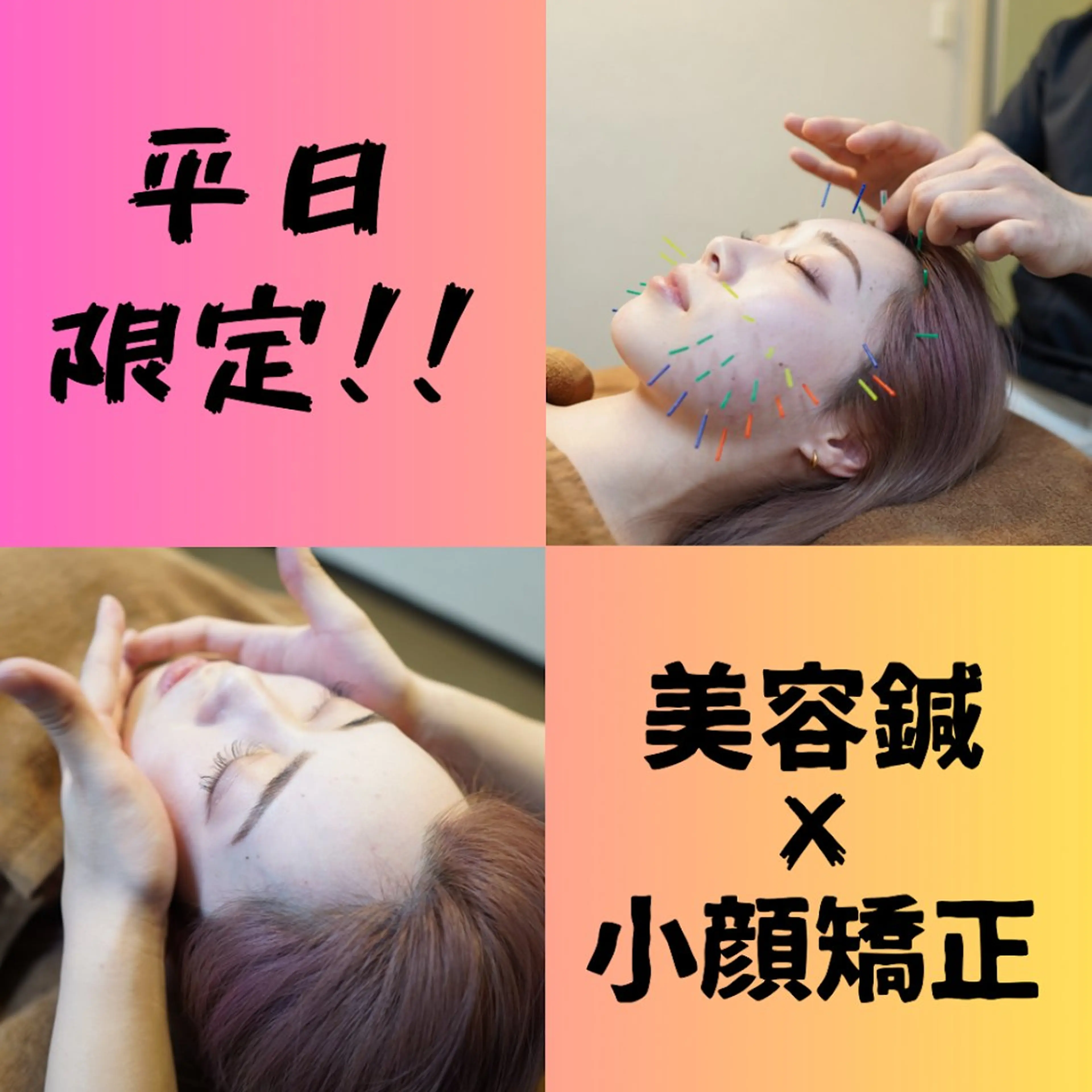 平日限定 ✨最強小顔コース✨【小顔矯正×美容鍼×首肩リンパケア】浮腫み/左右差/エラ張り/肌質改善/くすみ/たるみケアの写真