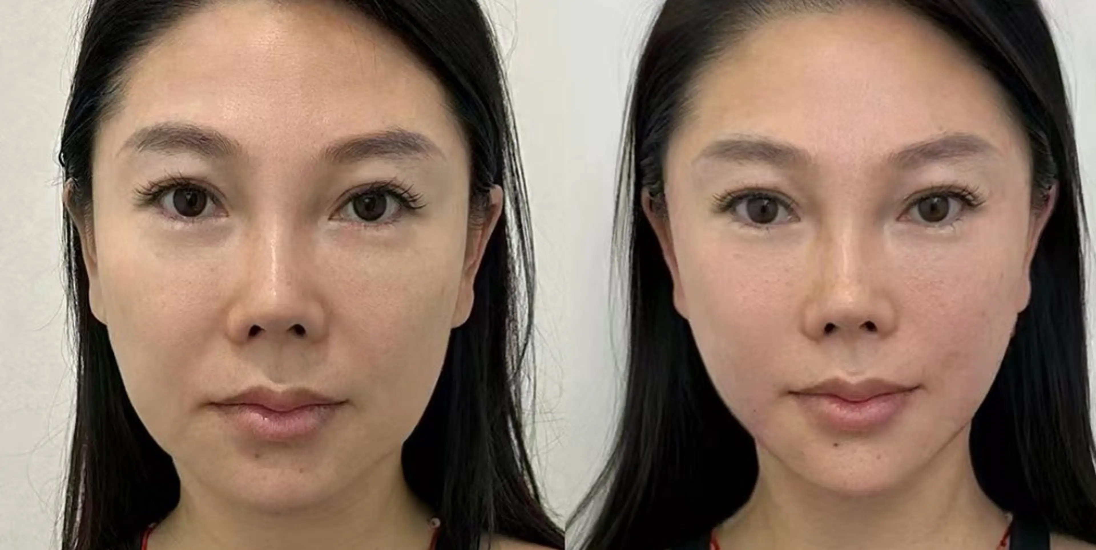 マツエク・マツパ エステ aliaハイフ&水光ジェットサロン所属・aliaハーブ水光店 エステティシャン募集のエステ・リラクイメージ