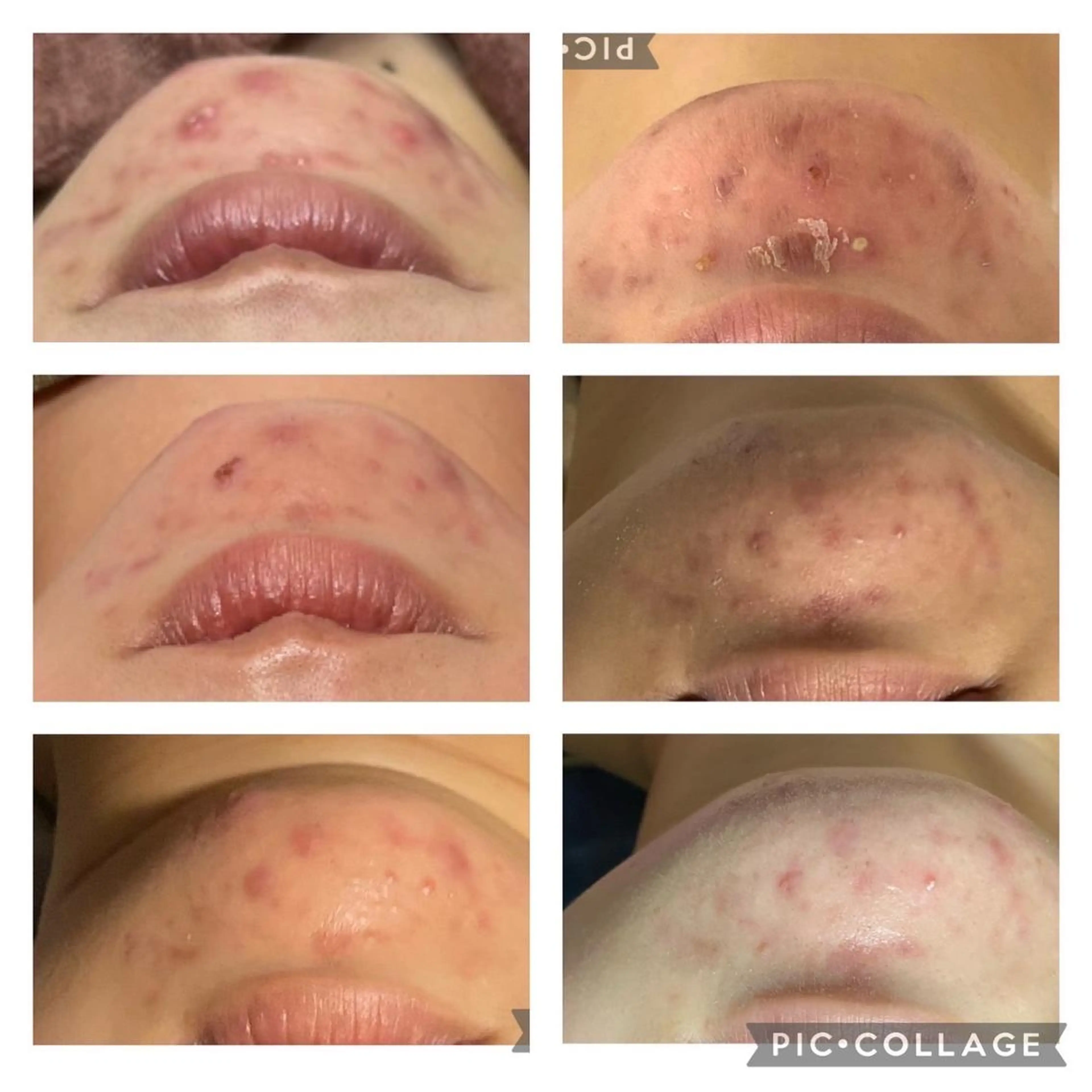 👑Linolaby RAYVIS👑💗のエステ・リラクイメージ