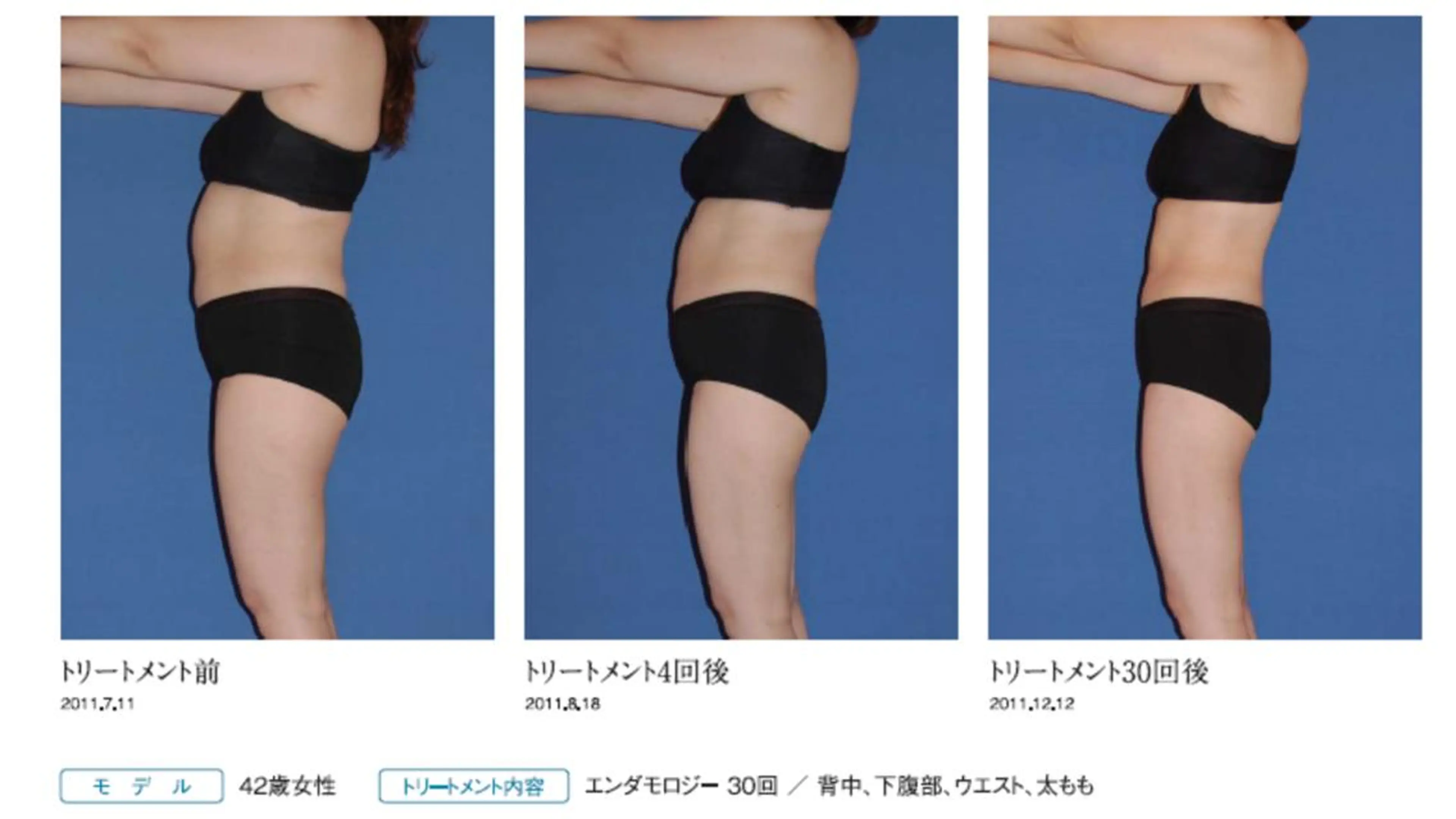 オレンジバナナ 県央店のエステ・リラクイメージ