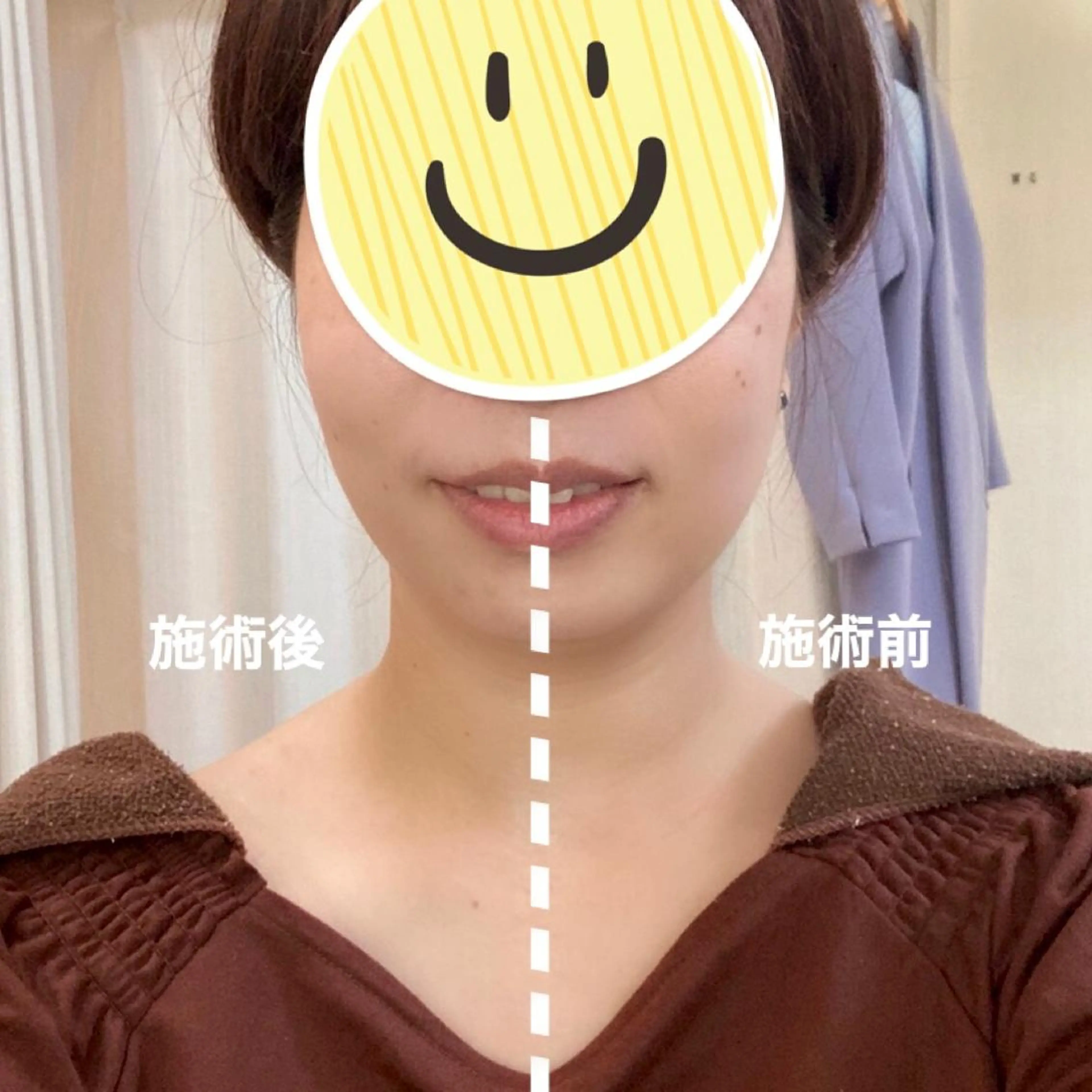 エステ リラク 小顔美肌&ヘアメイク 丸山紗來のエステ・リラクイメージ