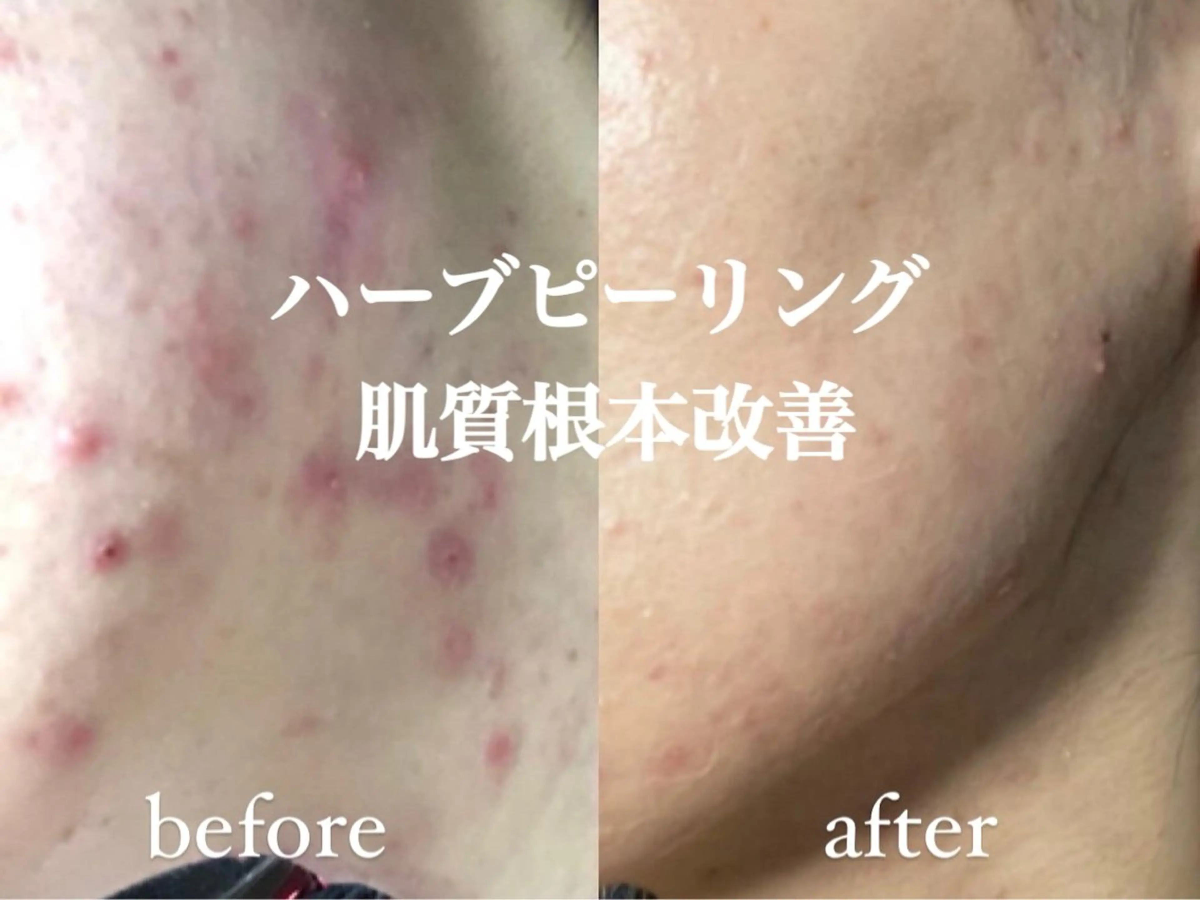 エステ 肌管理サロン neoriiのその他イメージ