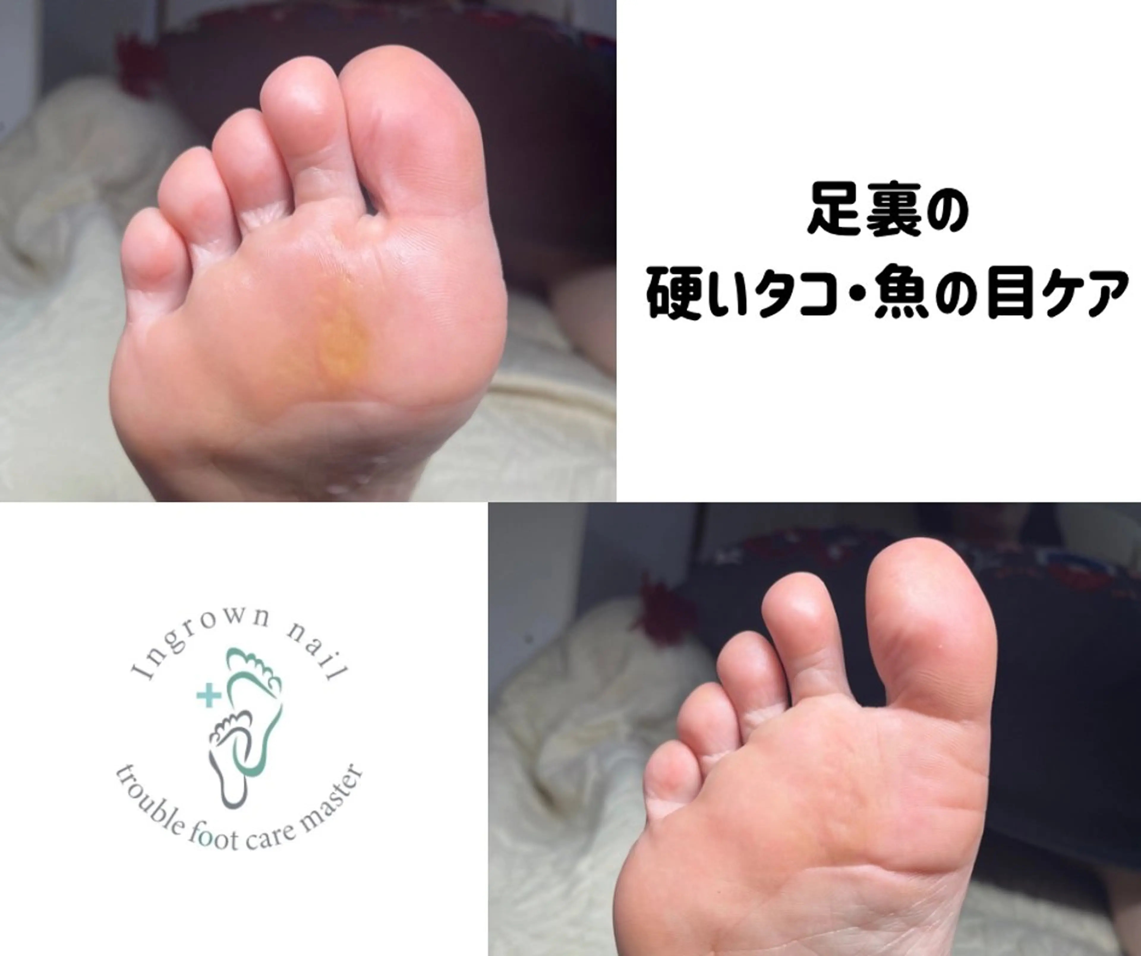 ネイル フットネイル rangrang nailのネイルデザイン