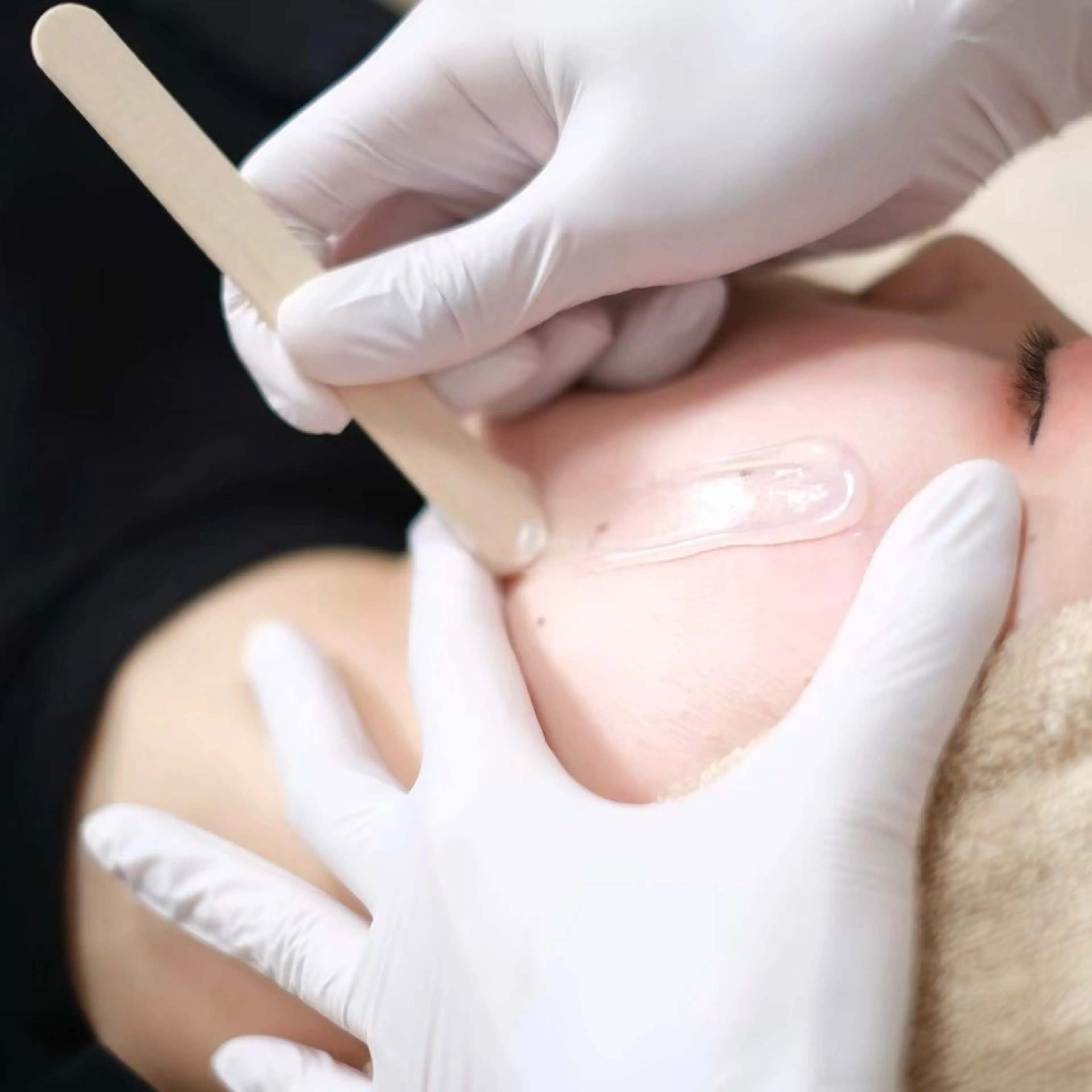 🌿【新規】フェイスWAX＋光脱毛（9,900円）《メイクノリ爆上がり》毛と古い角質を同時にケアする人気セットの写真