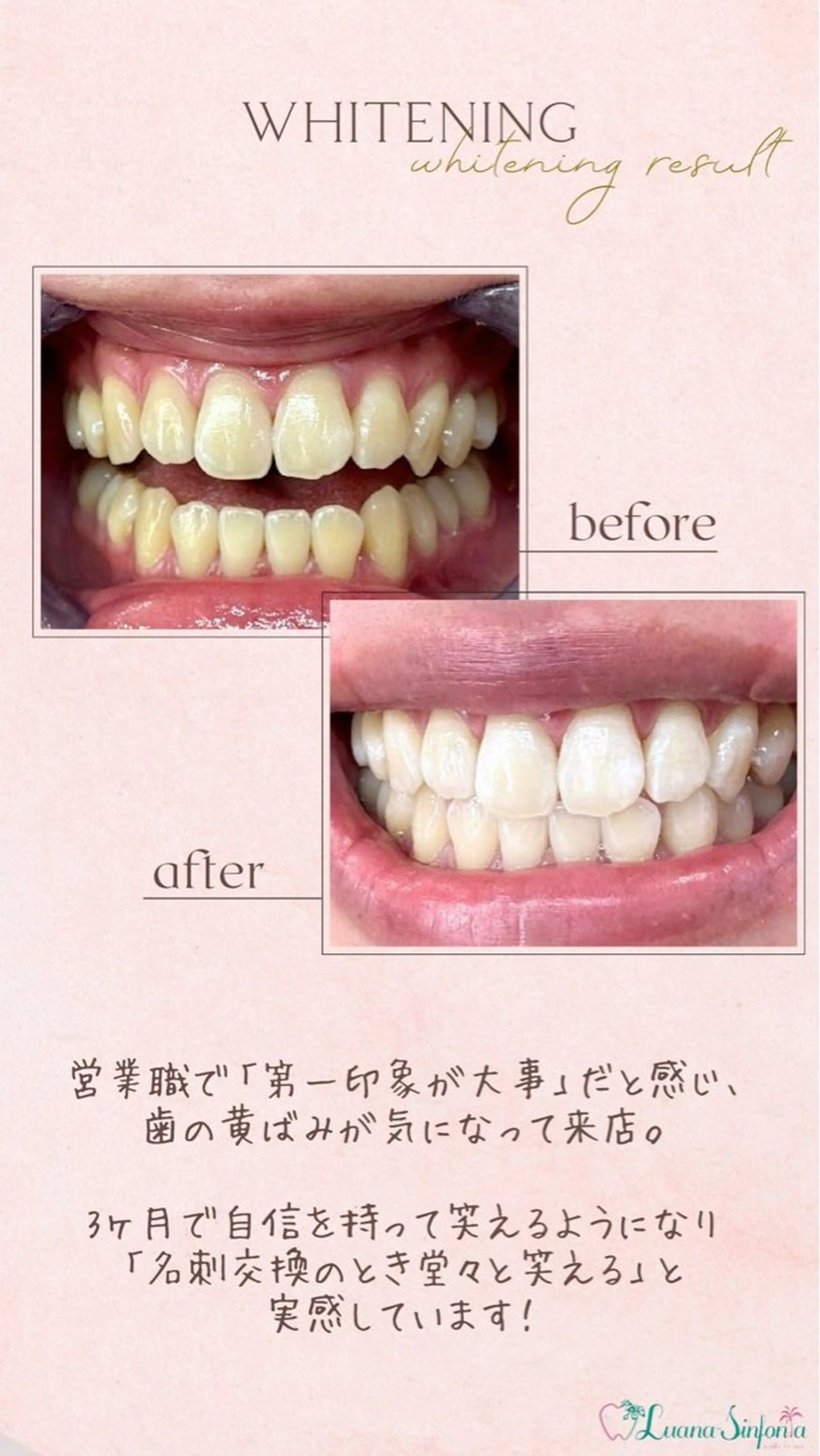 ホワイトニングサロンLuana-Sinfonia(エクシア)池袋店所属・セルフホワイトニング エクシア 池袋店のその他イメージ