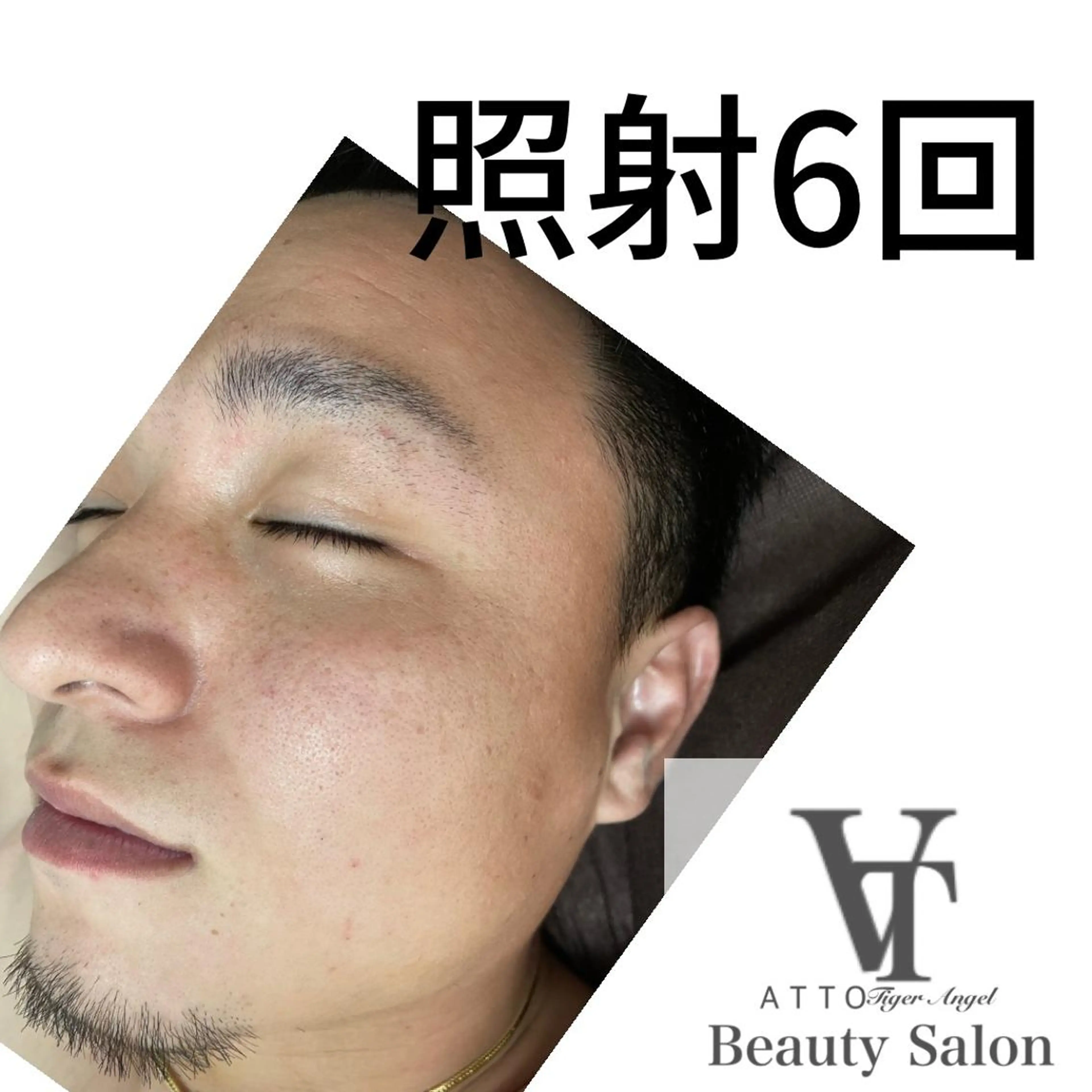 脱毛 ATTO SHIORIのエステ・リラクイメージ