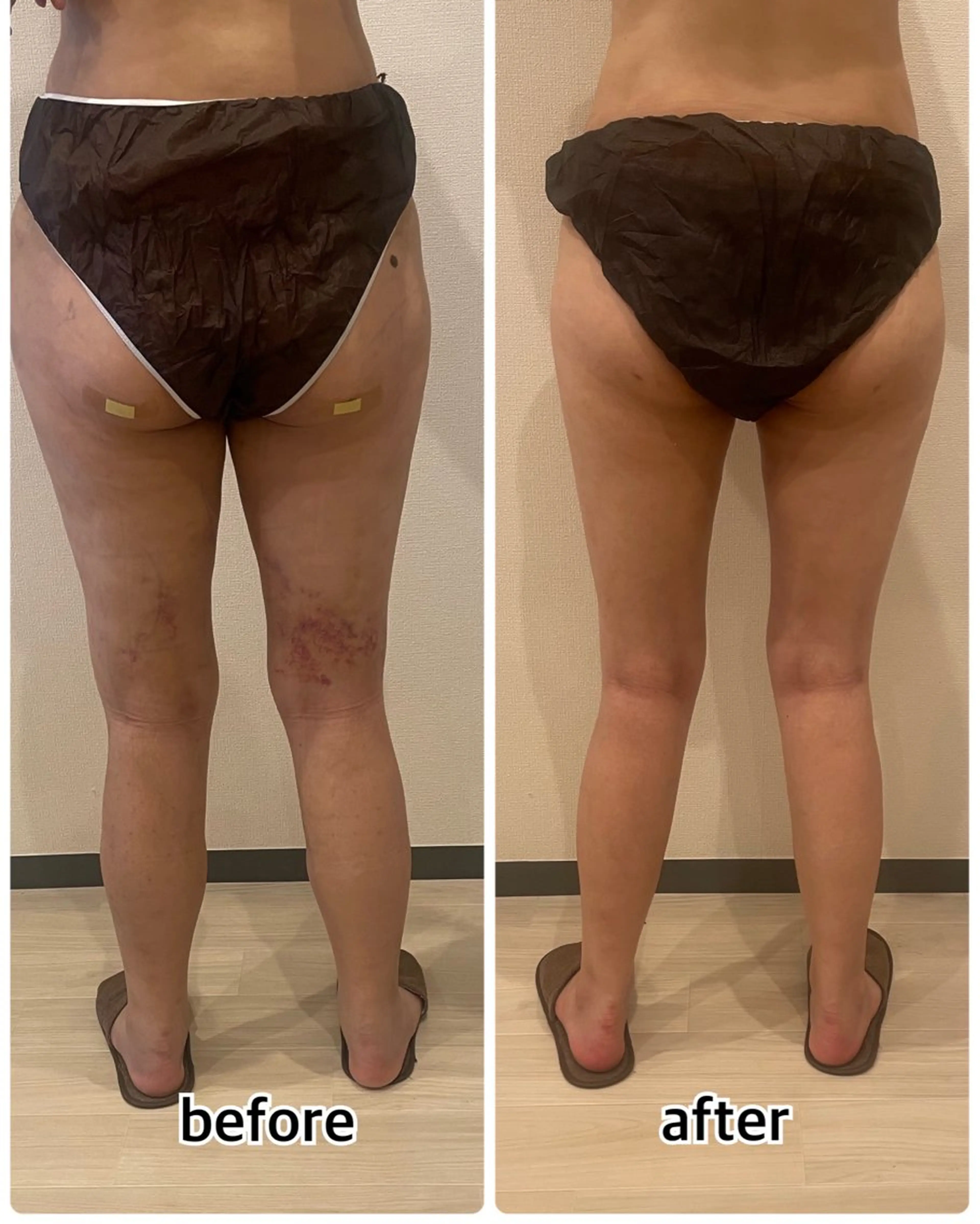 💎インディバ GEM💎indiba   healing room GEM所属・💎 GEM💎のエステ・リラクイメージ