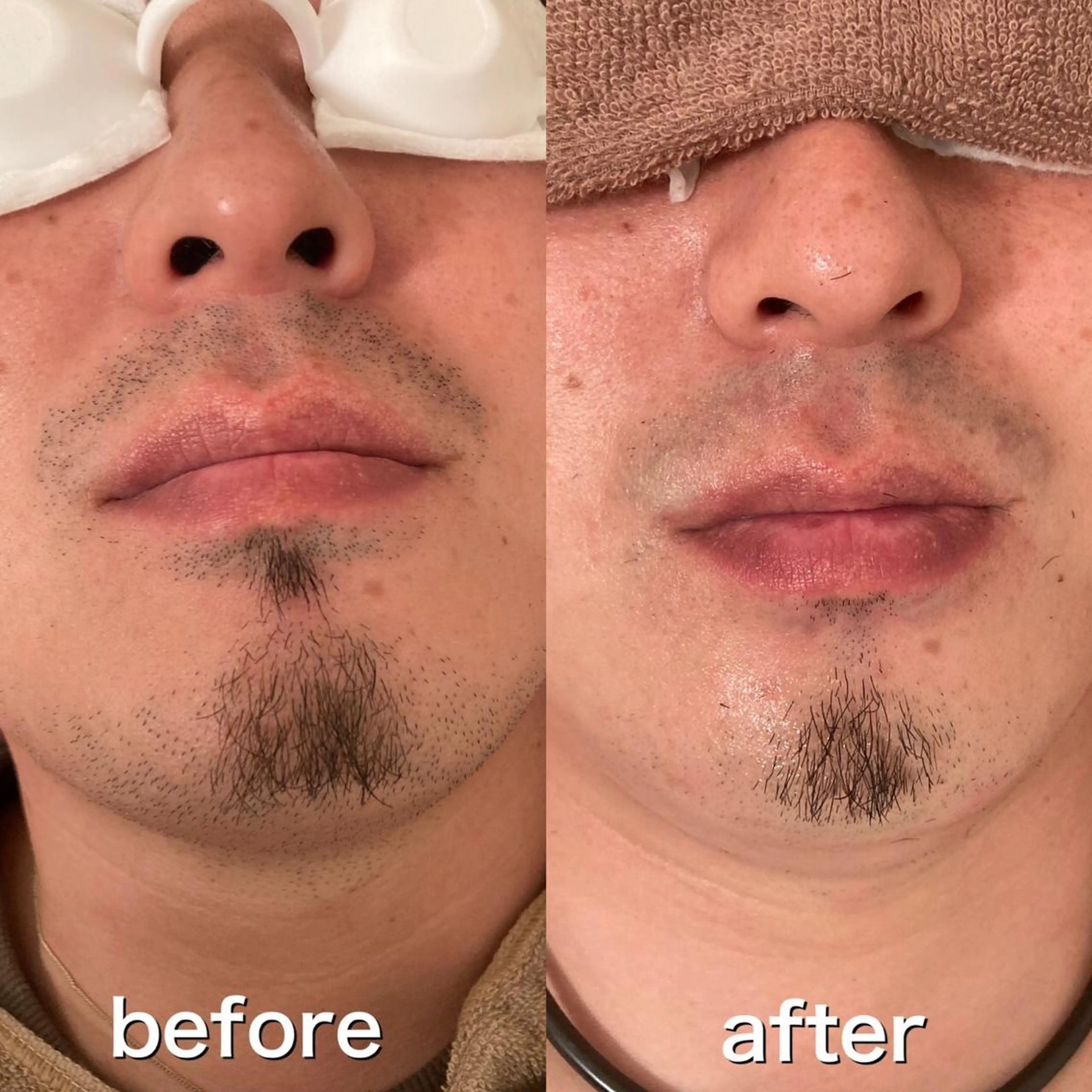 メンズ プライベートサロンLien所属・都度払い脱毛店 Lienリアンのエステ・リラクイメージ