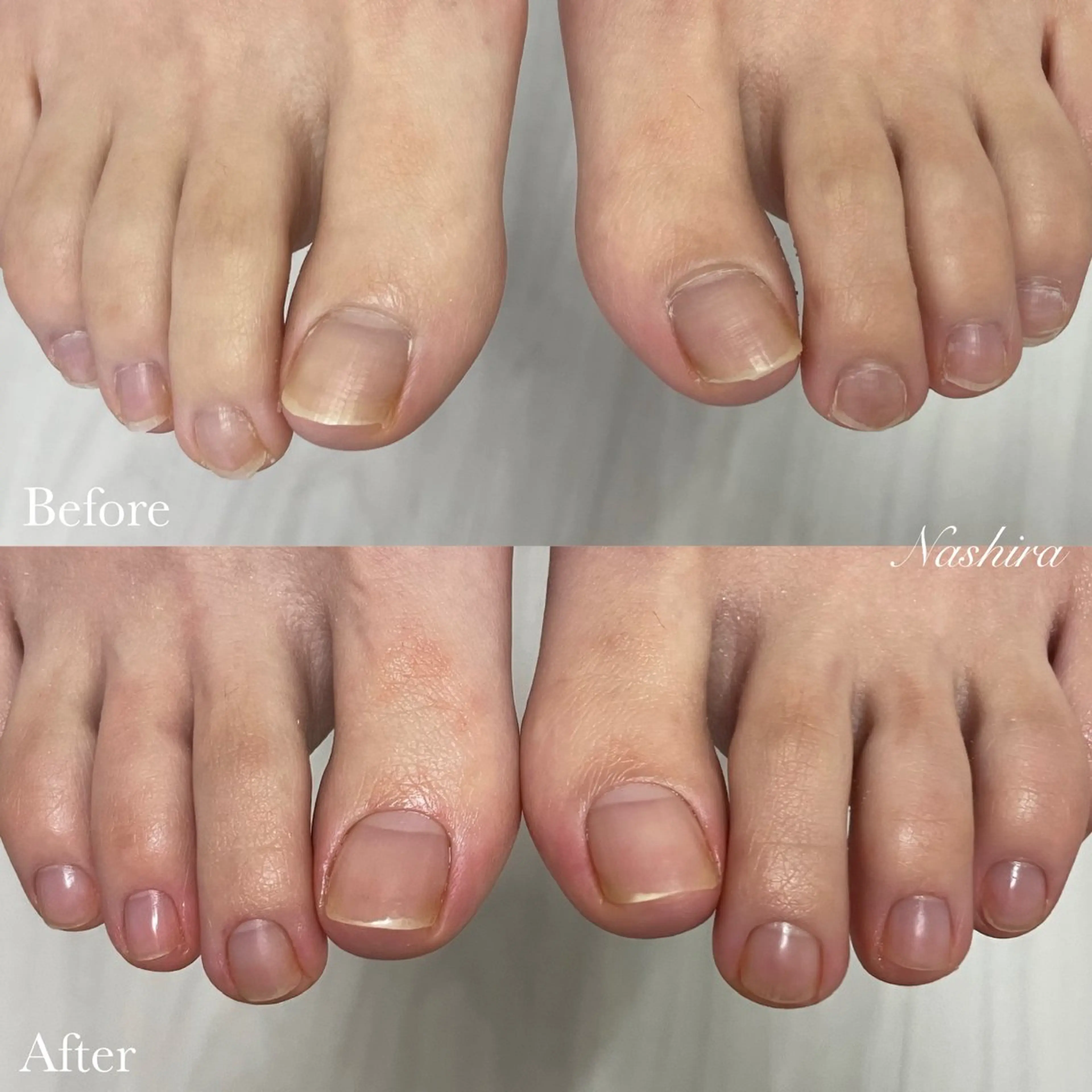 【フット】こだわりケアの写真