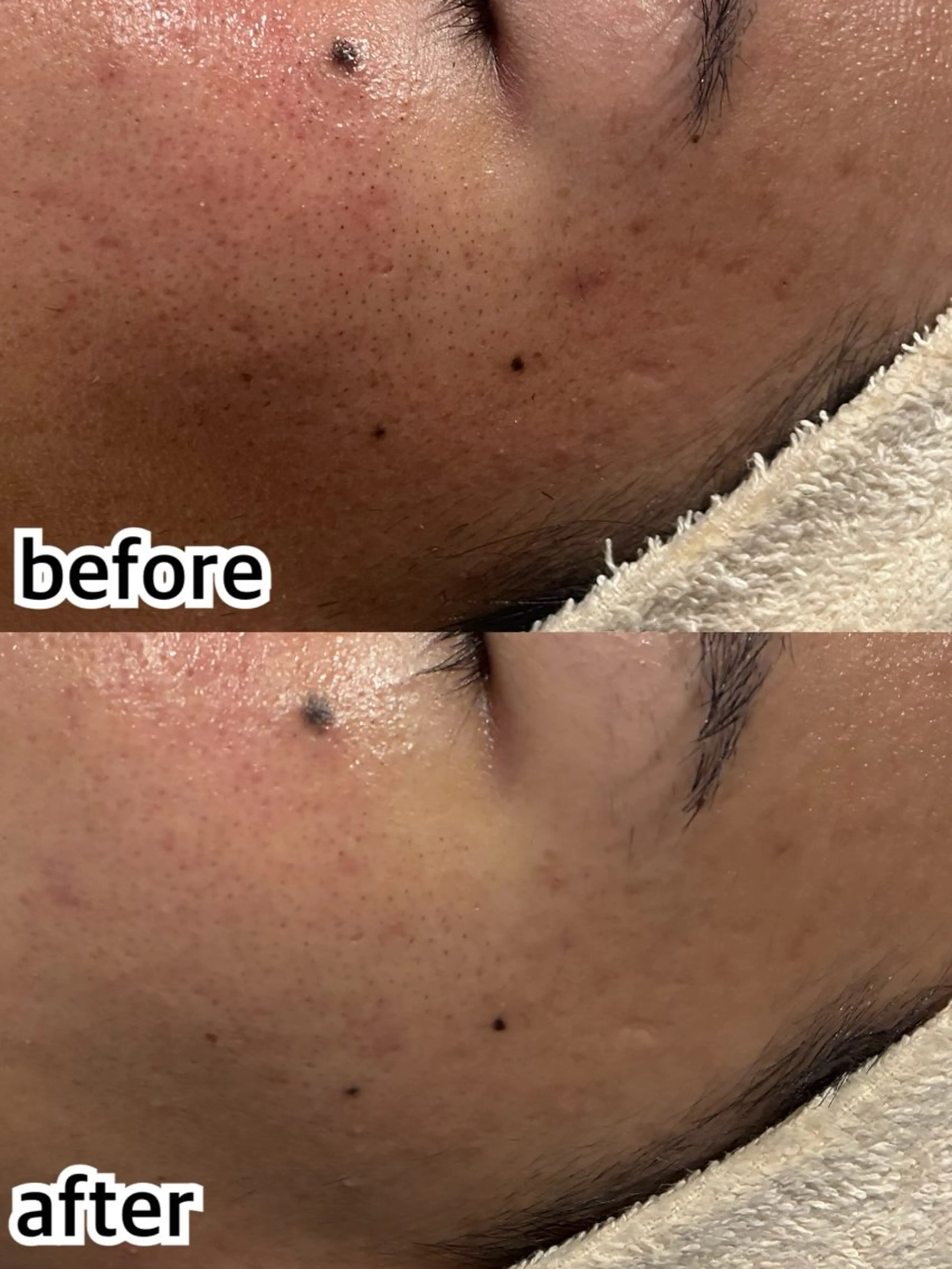 エステ 韓国肌管理専門店　White labo 梅田店所属・大西 亜季のエステ・リラクイメージ