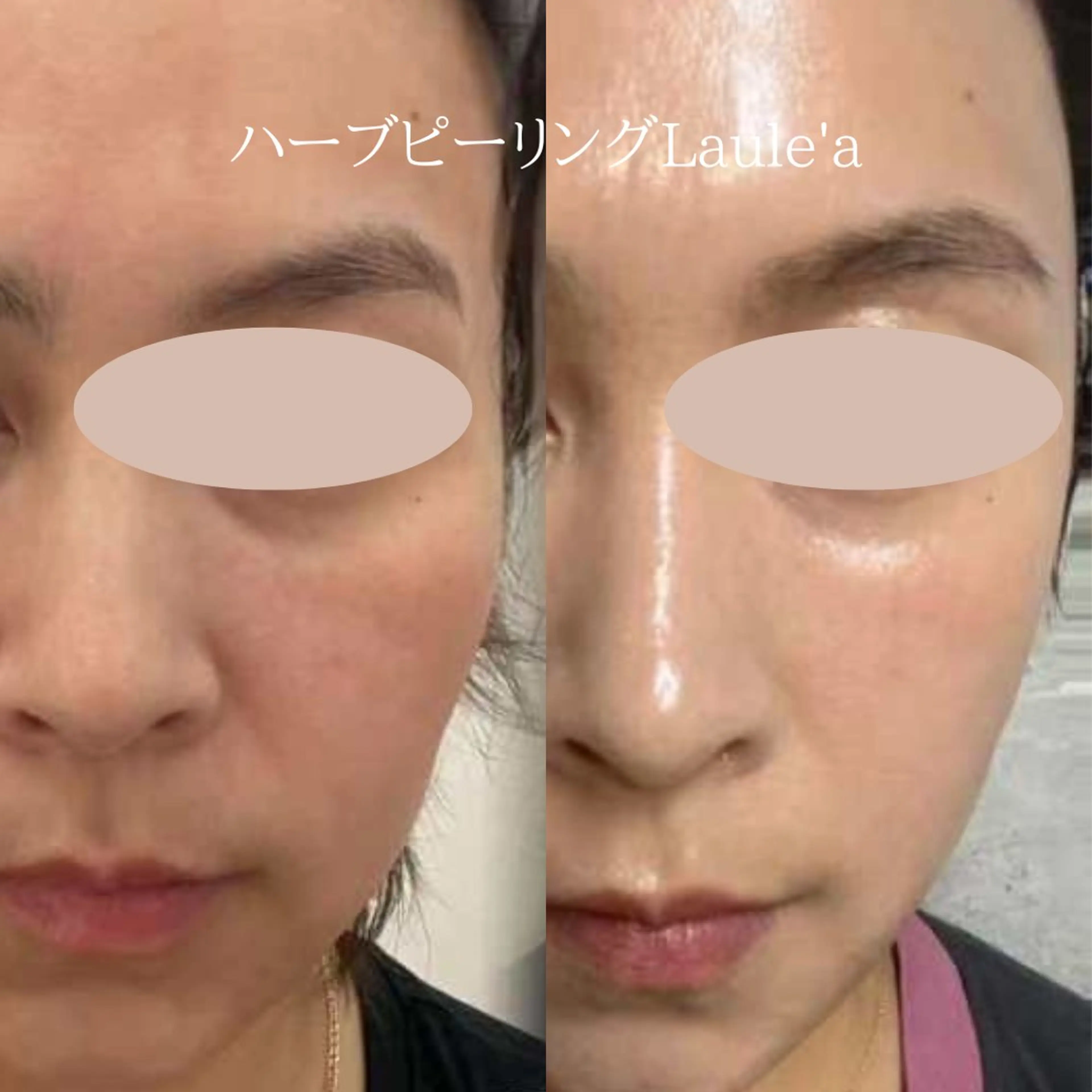 美腸サロン🌺 腸もみ/小顔/リンパのエステ・リラクイメージ