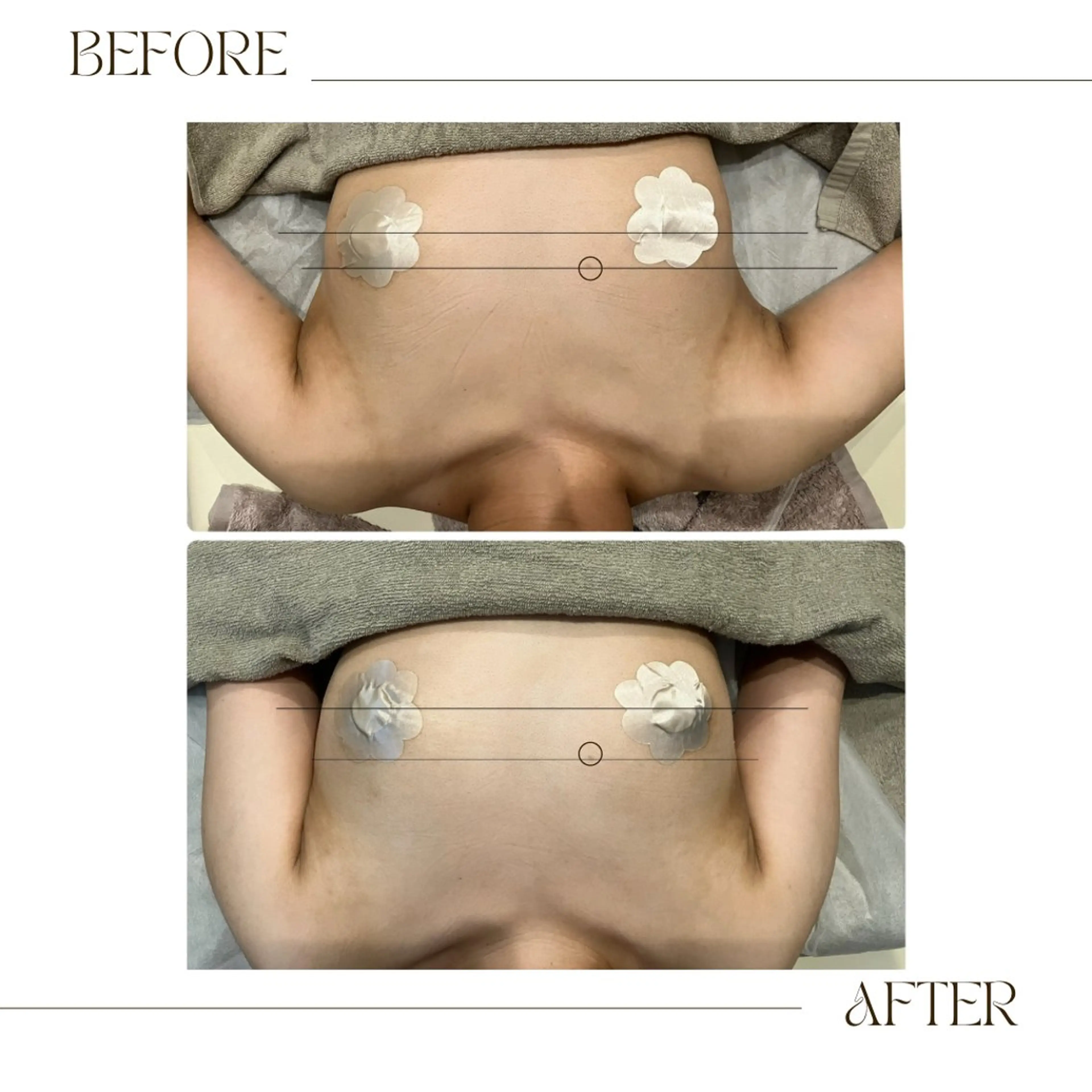 その他 infinity所属・Infinity インフィニティのその他イメージ