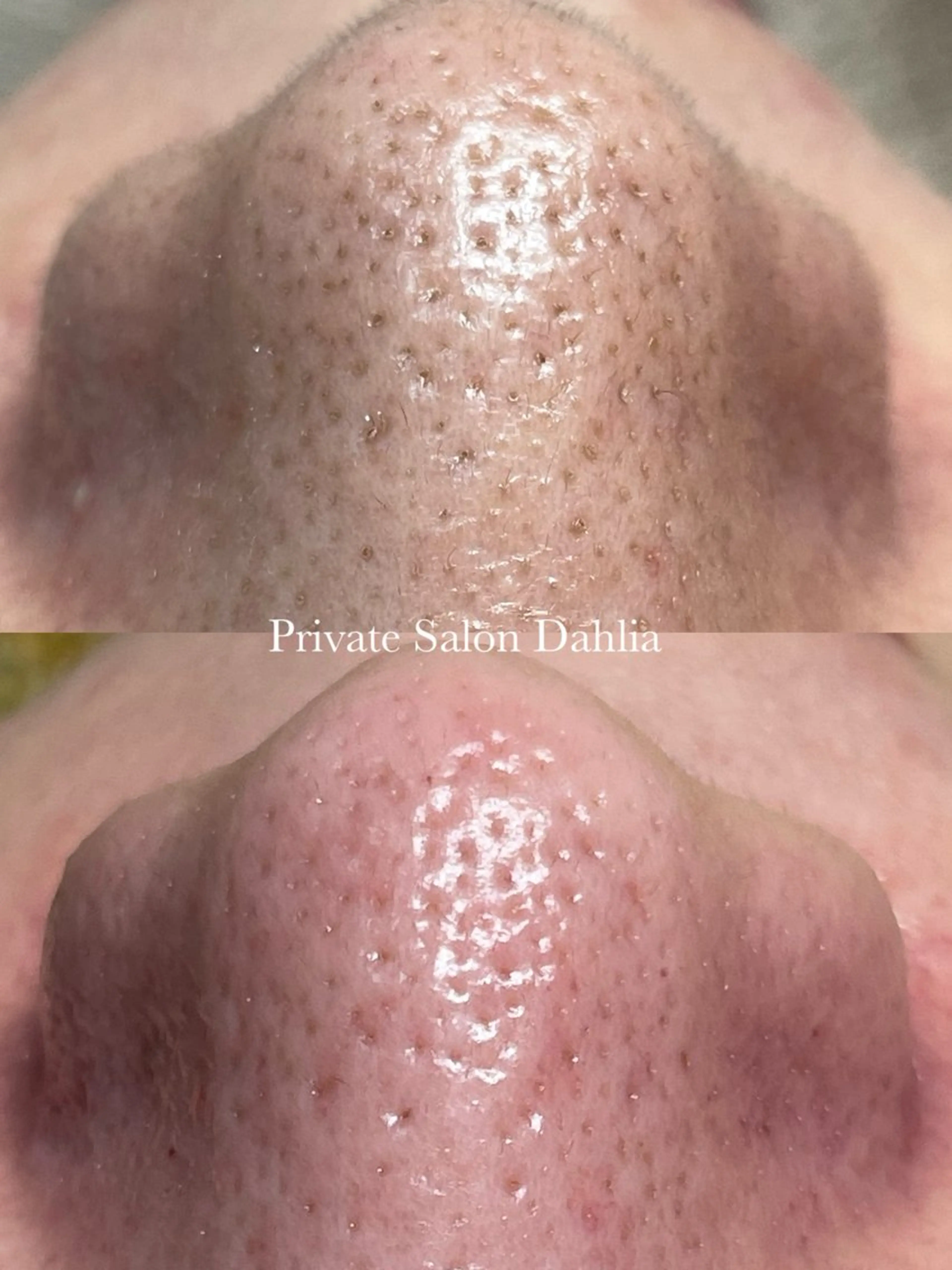 エステ Private Salon Dahlia所属・中田 さやかの眉毛・アイブロウイメージ