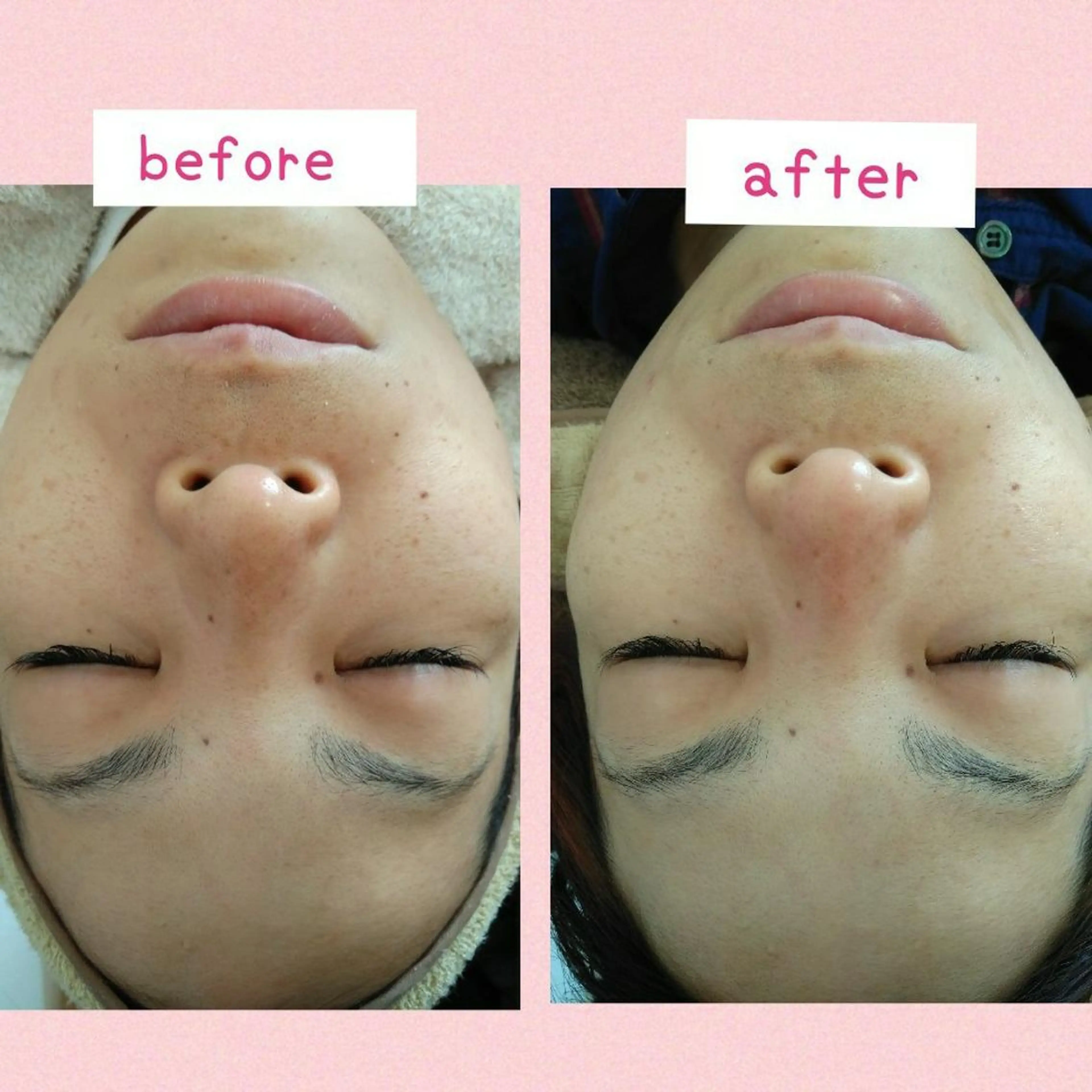 エステ プライベートサロン LaLa 北山まいこのエステ・リラクイメージ