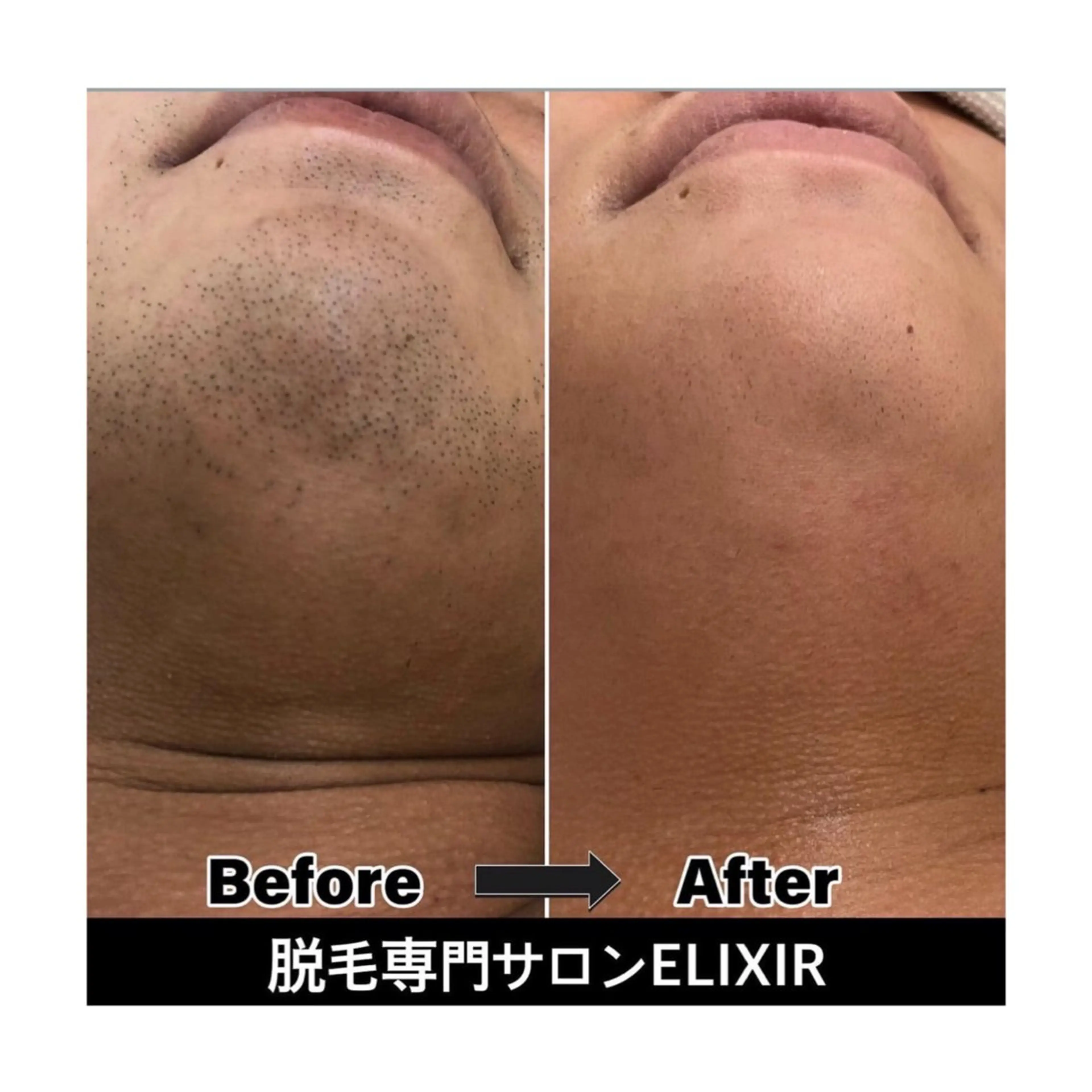 脱毛専門サロンElixir加須店所属・脱毛専門サロン Elixir　加須店のエステ・リラクイメージ