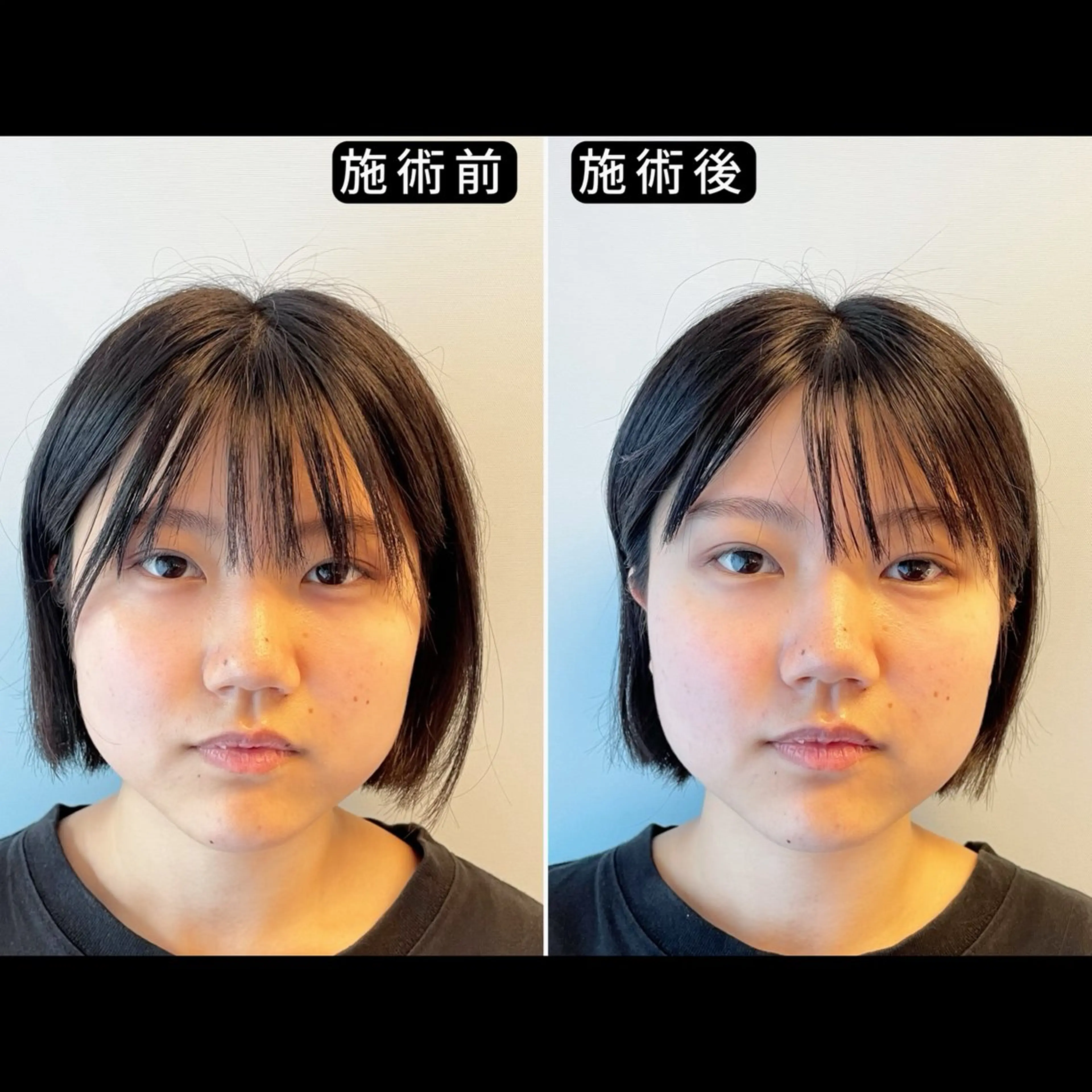 エステ リラク 渋谷 小顔美容鍼 専門サロン YZのエステ・リラクイメージ