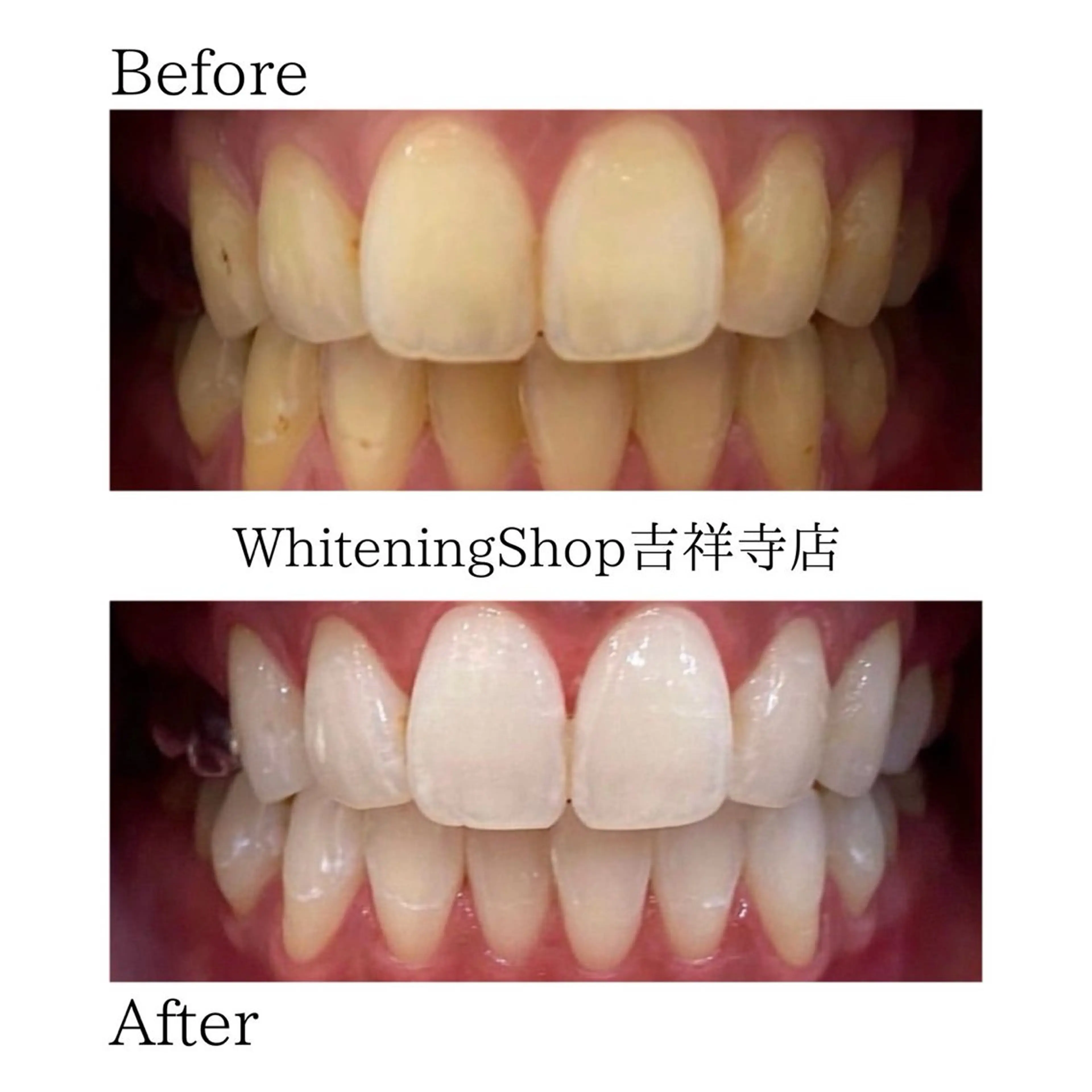 エステ リラク ホワイトニング ショップ吉祥寺店のエステ・リラクイメージ