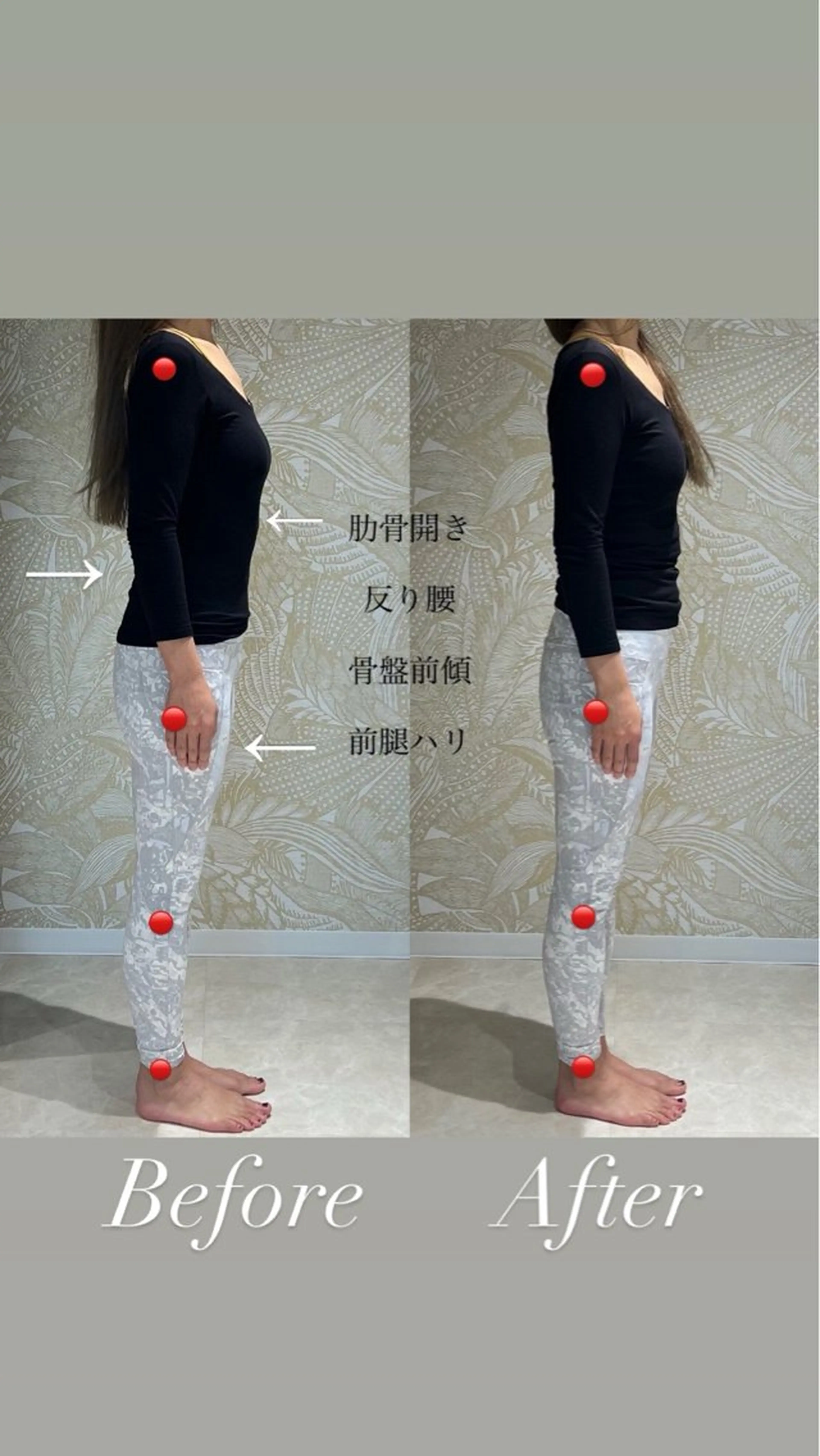 姿勢美人✨ダイエット矯正【骨盤矯正×フェムケア矯正】60分（カウンセリング含む）の写真