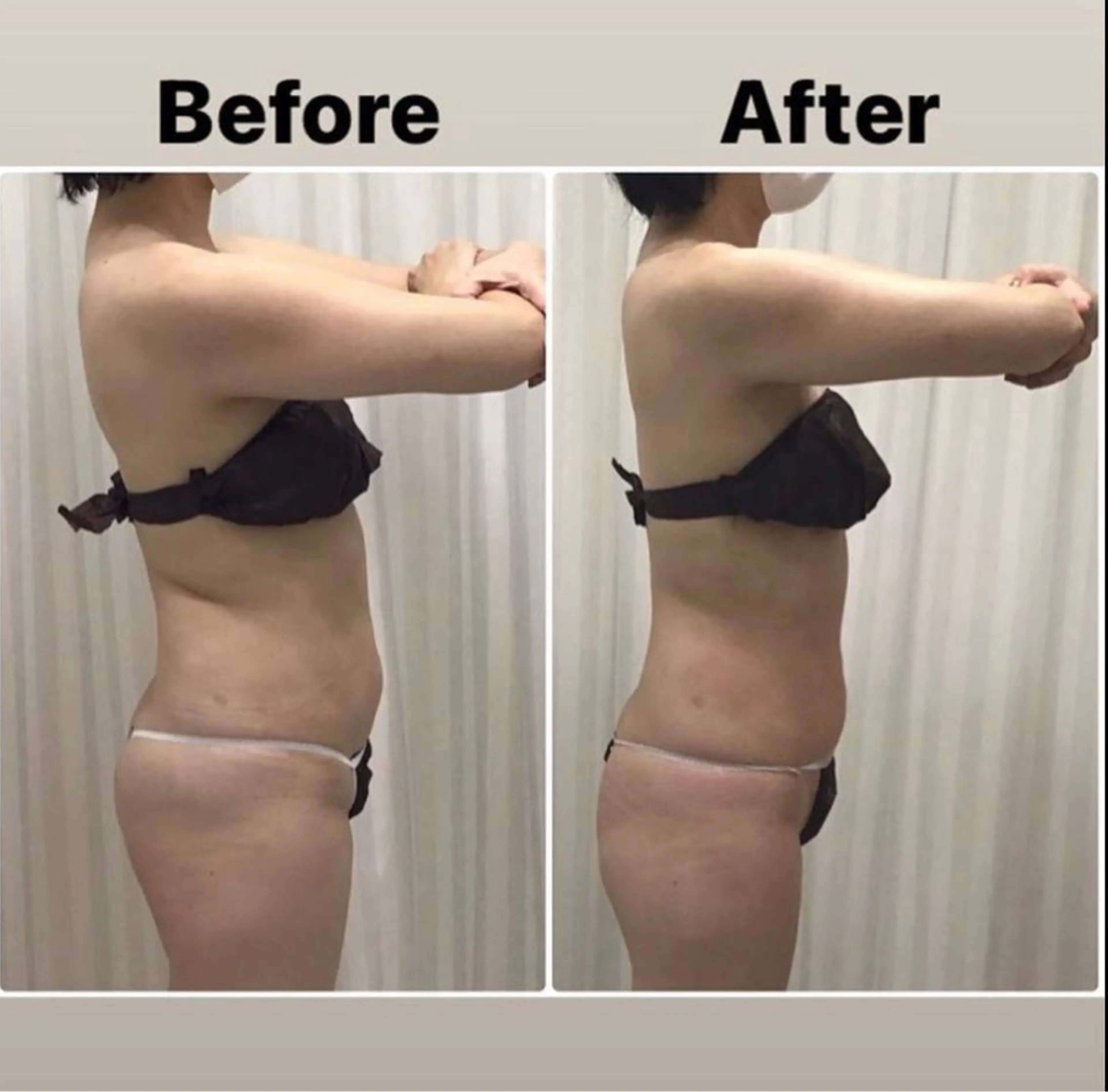 痩身/美肌/脱毛 MAX BEAUTYのエステ・リラクイメージ