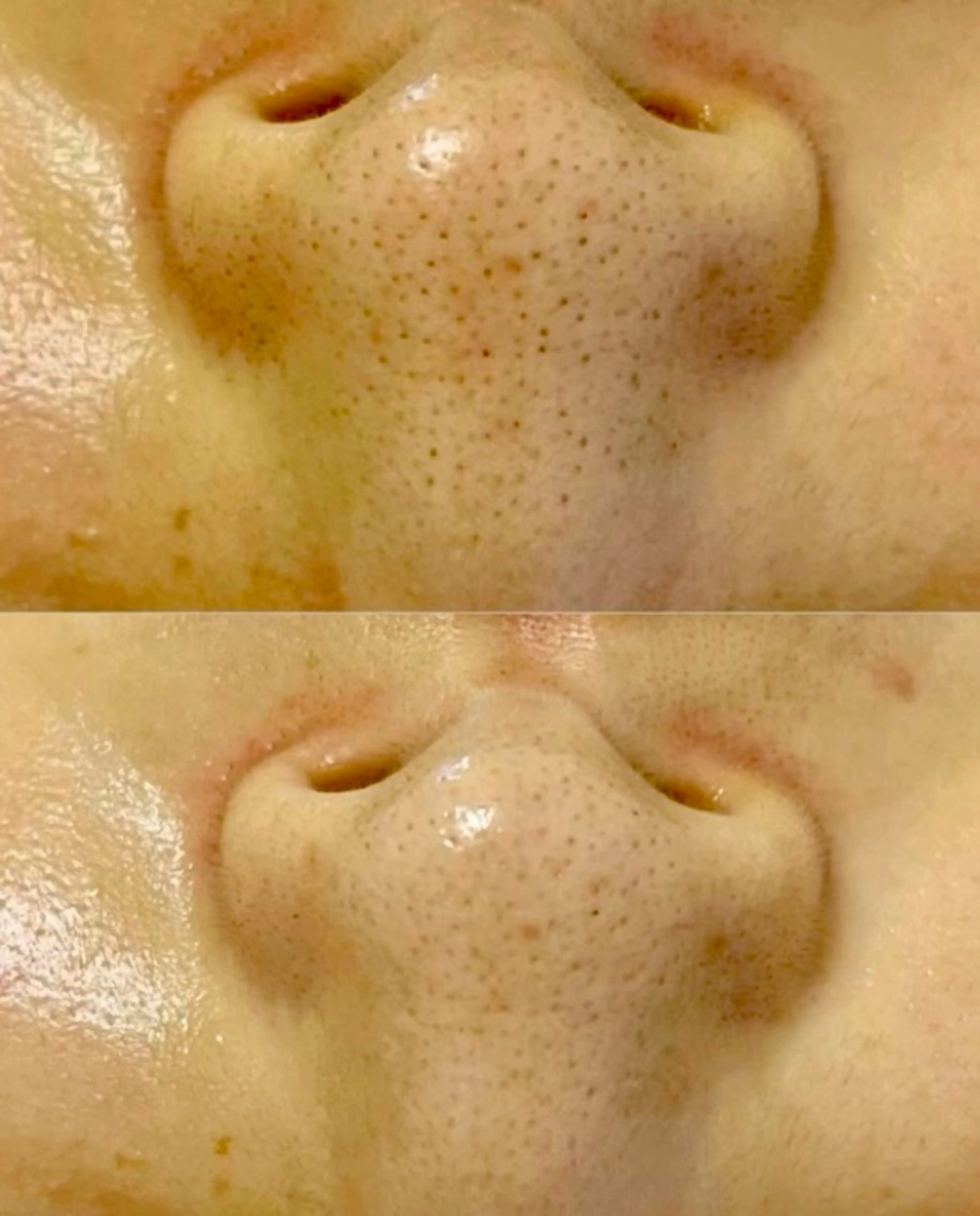 看護師が施術する美容 ナスサロ／小泉のエステ・リラクイメージ