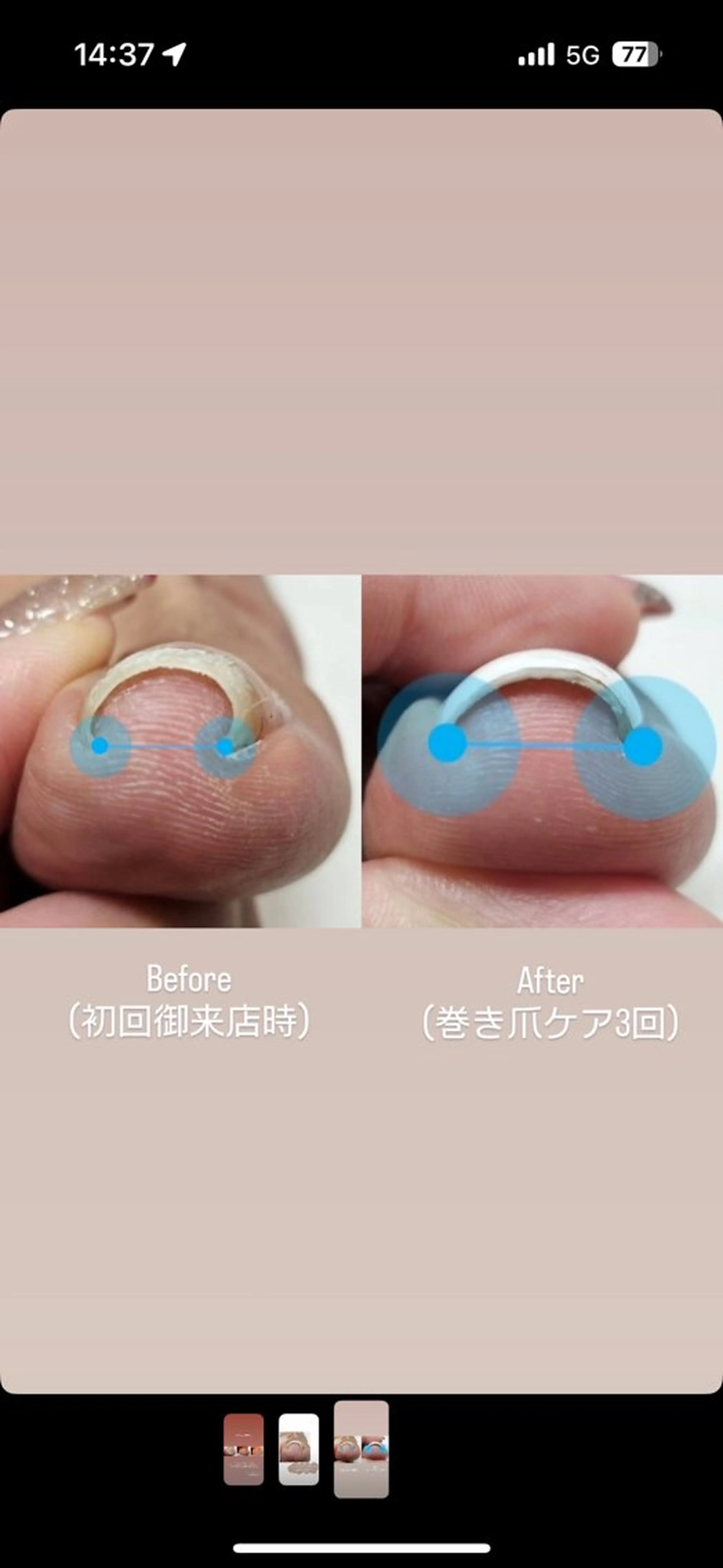 ネイル Yurika Katahiraのネイルデザイン