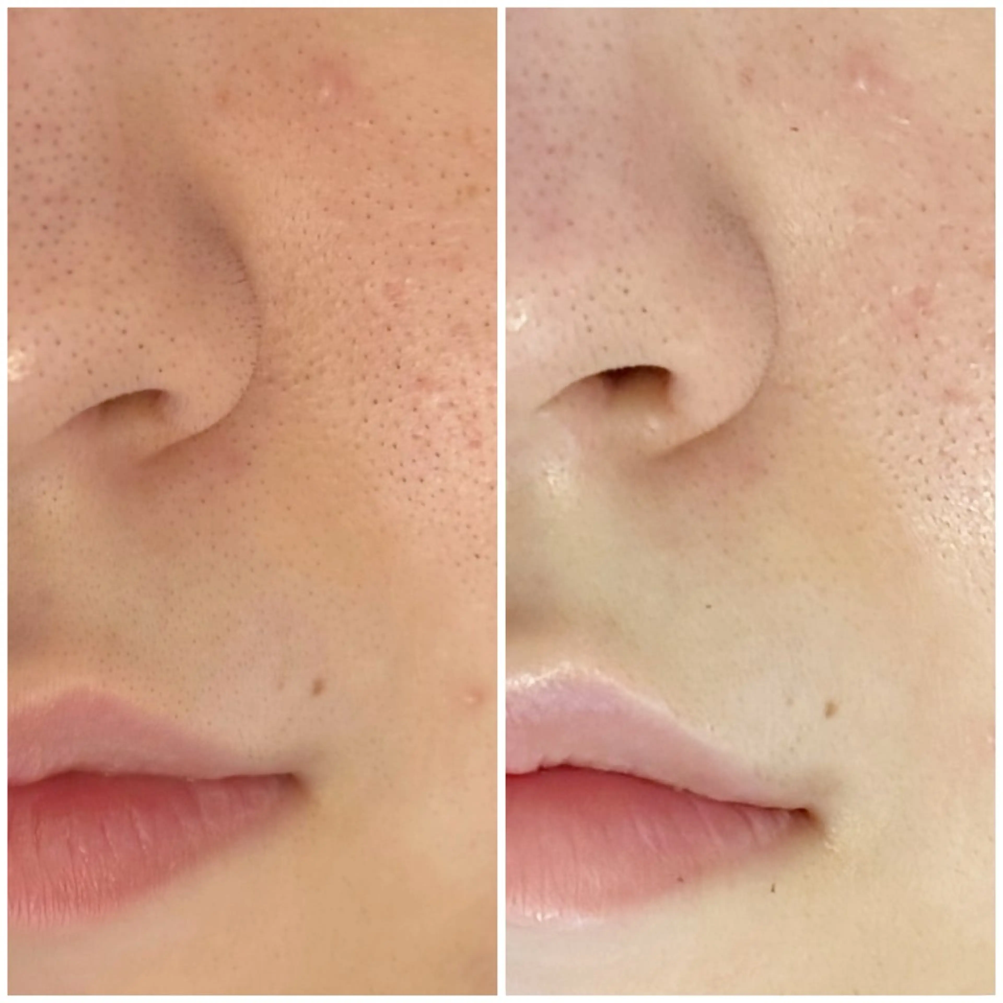 エステ LUARAフェイシャルサロン 新御徒町店所属・ルアラ エステのエステ・リラクイメージ