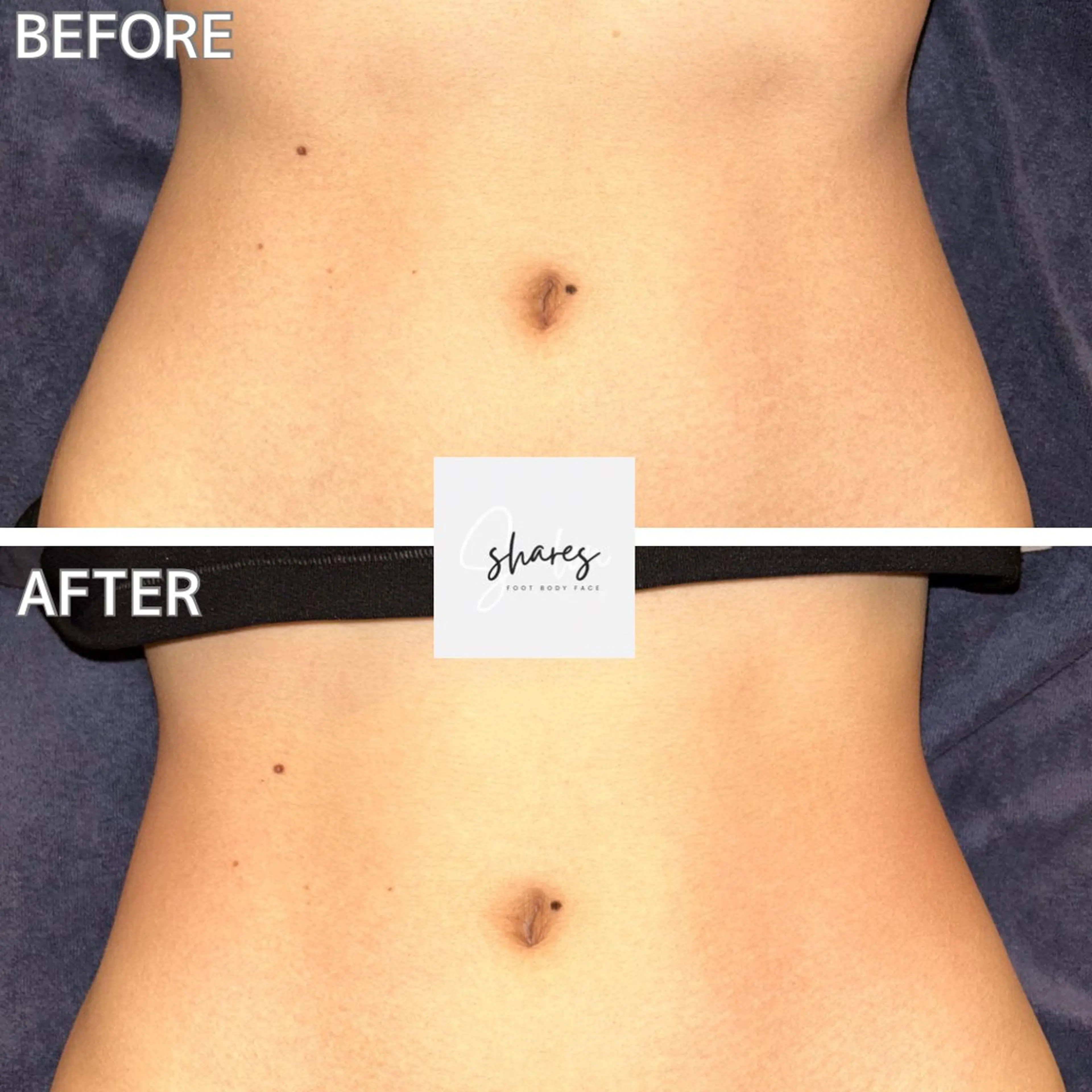 salon shares 辻堂店所属・SHARES AOIのエステ・リラクイメージ