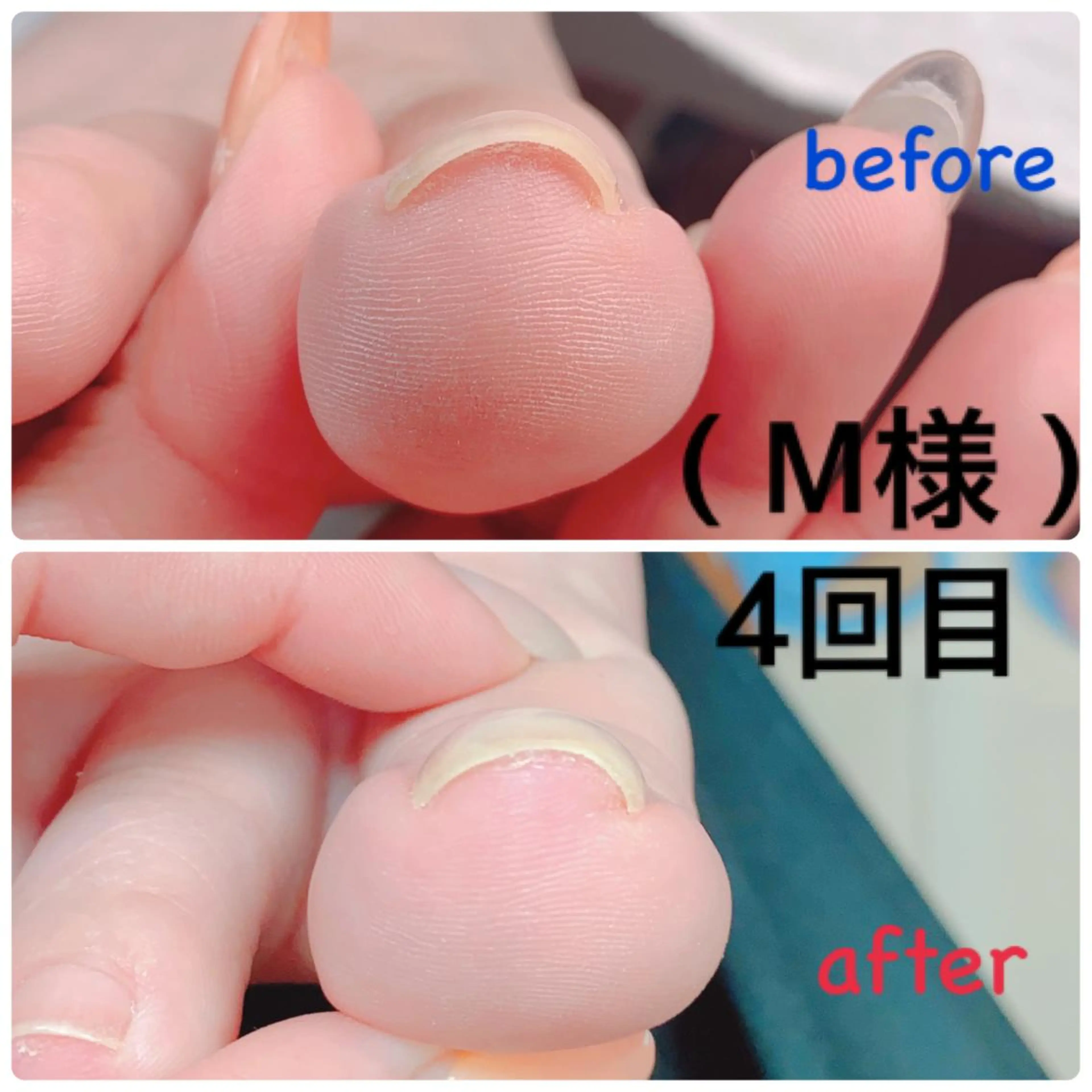 ネイル その他(ネイル) 柴崎 美幸のネイルデザイン