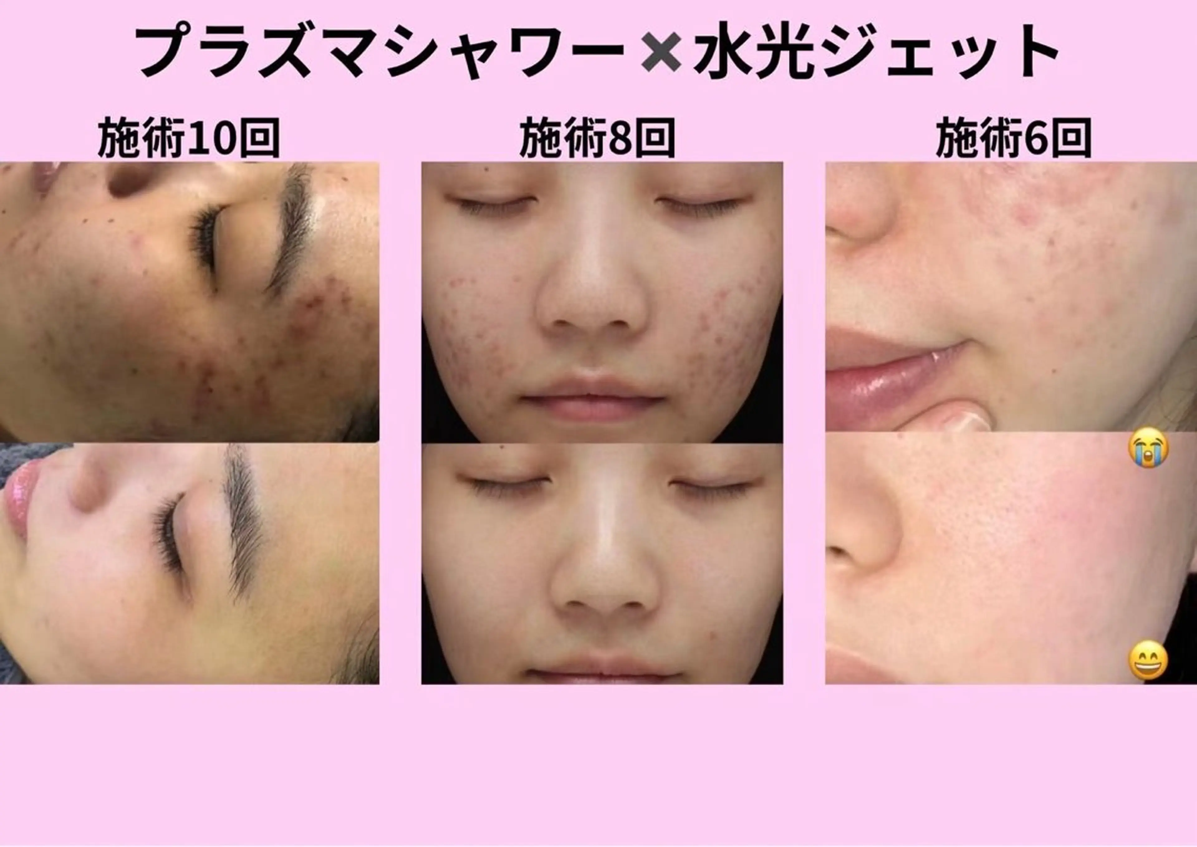 マツエク・マツパ エステ aliaハイフ&水光ジェットサロン所属・aliaハーブ水光店 エステティシャン募集のエステ・リラクイメージ