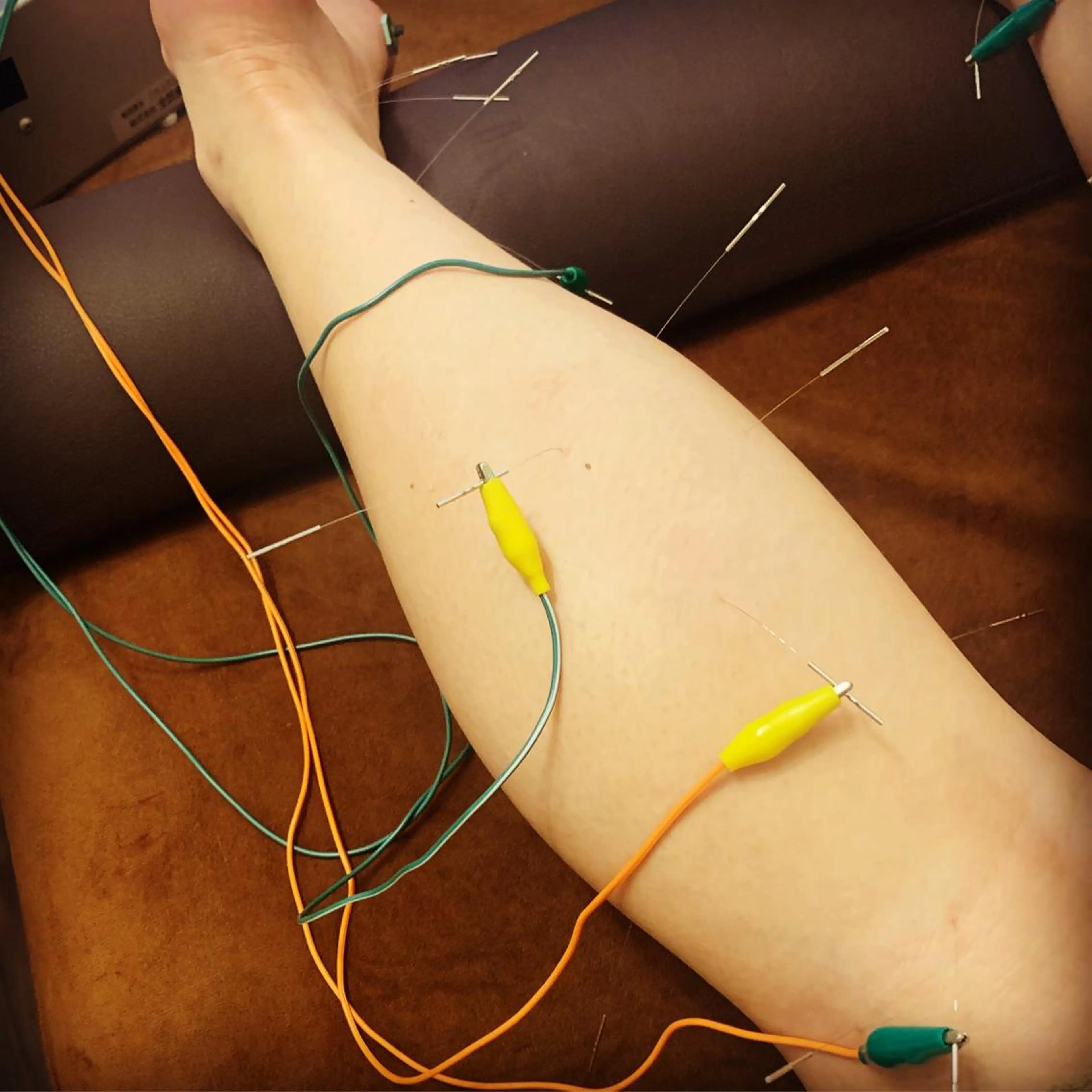 表参道鍼灸院K 美容鍼🔮ララピールのエステ・リラクイメージ