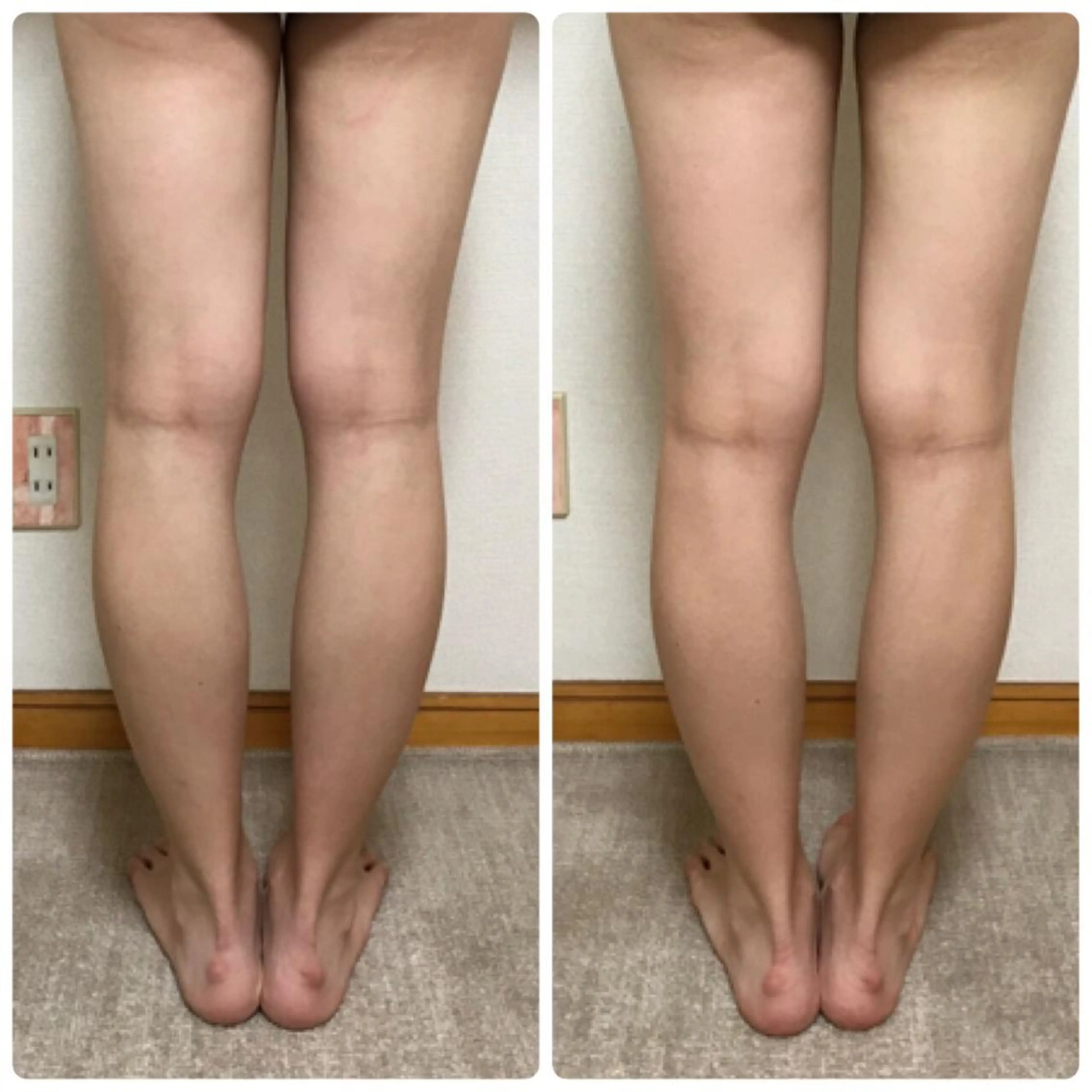 やまだ鍼灸接骨院（やまだしんきゅうせっこついん）所属・山田 晃のエステ・リラクイメージ