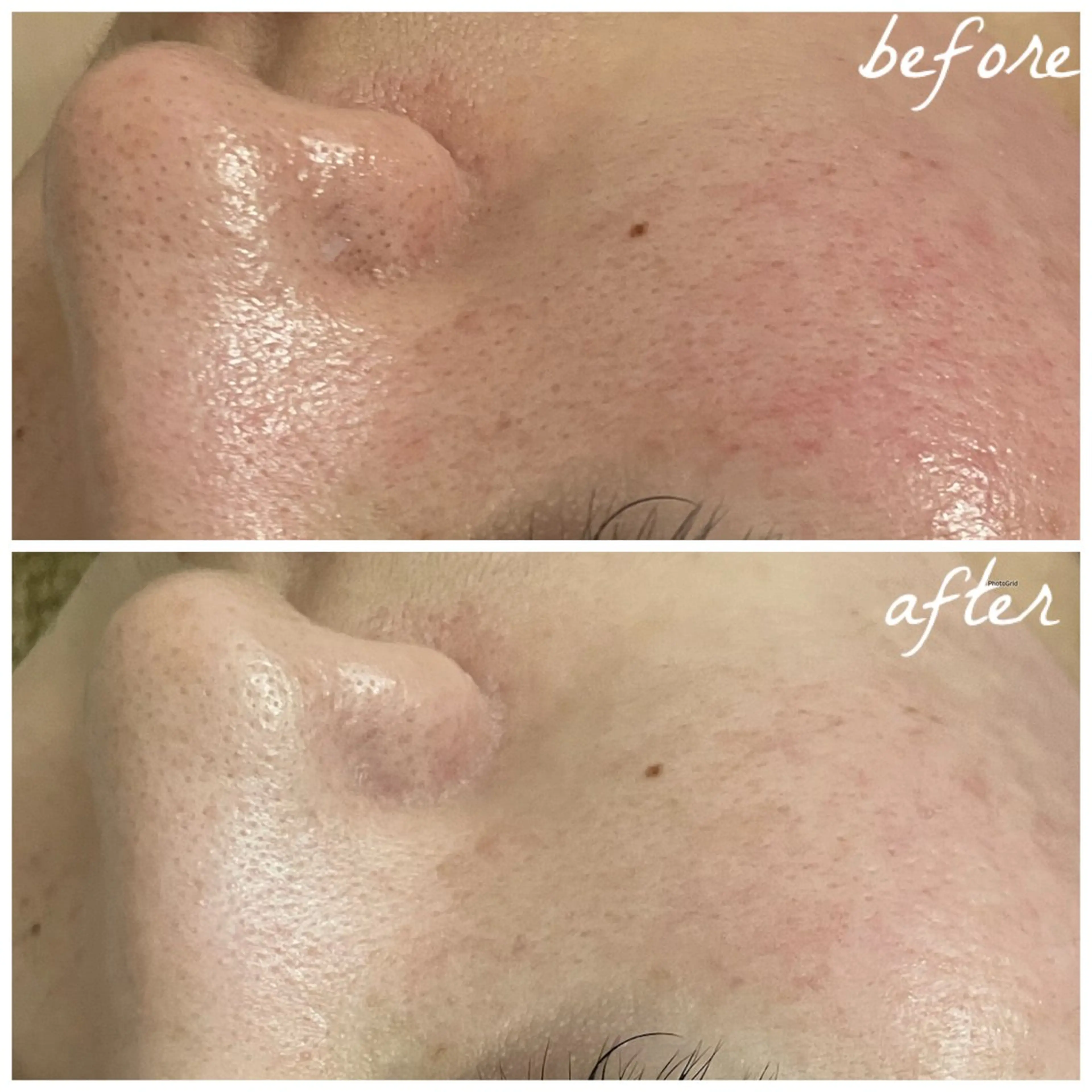 メンズ エステ メナード岐阜茜部 杉浦のエステ・リラクイメージ