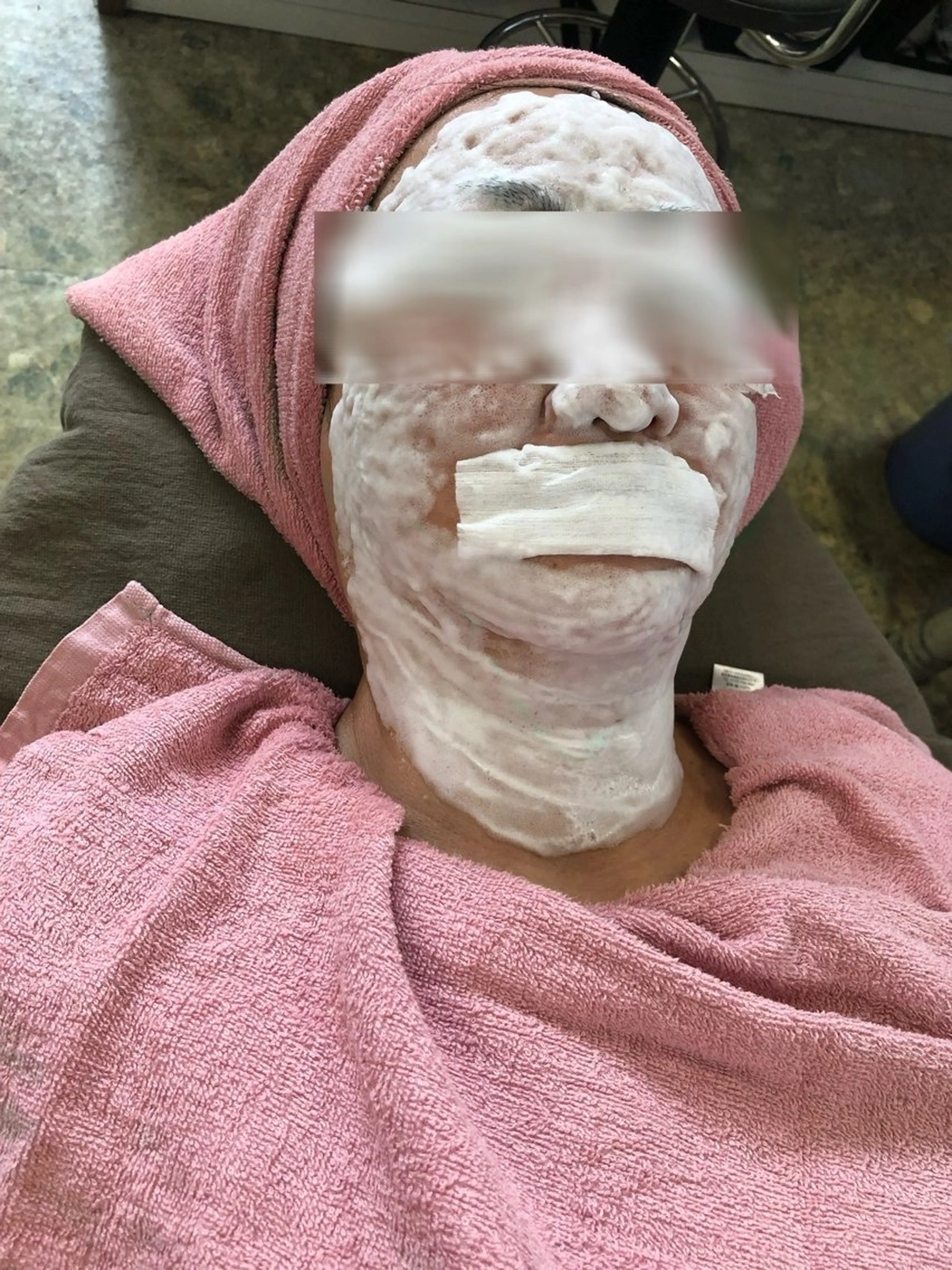 毛穴汚れ、ザラつき、テカリにおすすめ!毛穴ケア(ヘッドトリートメントまたはハンドケア付き)の写真