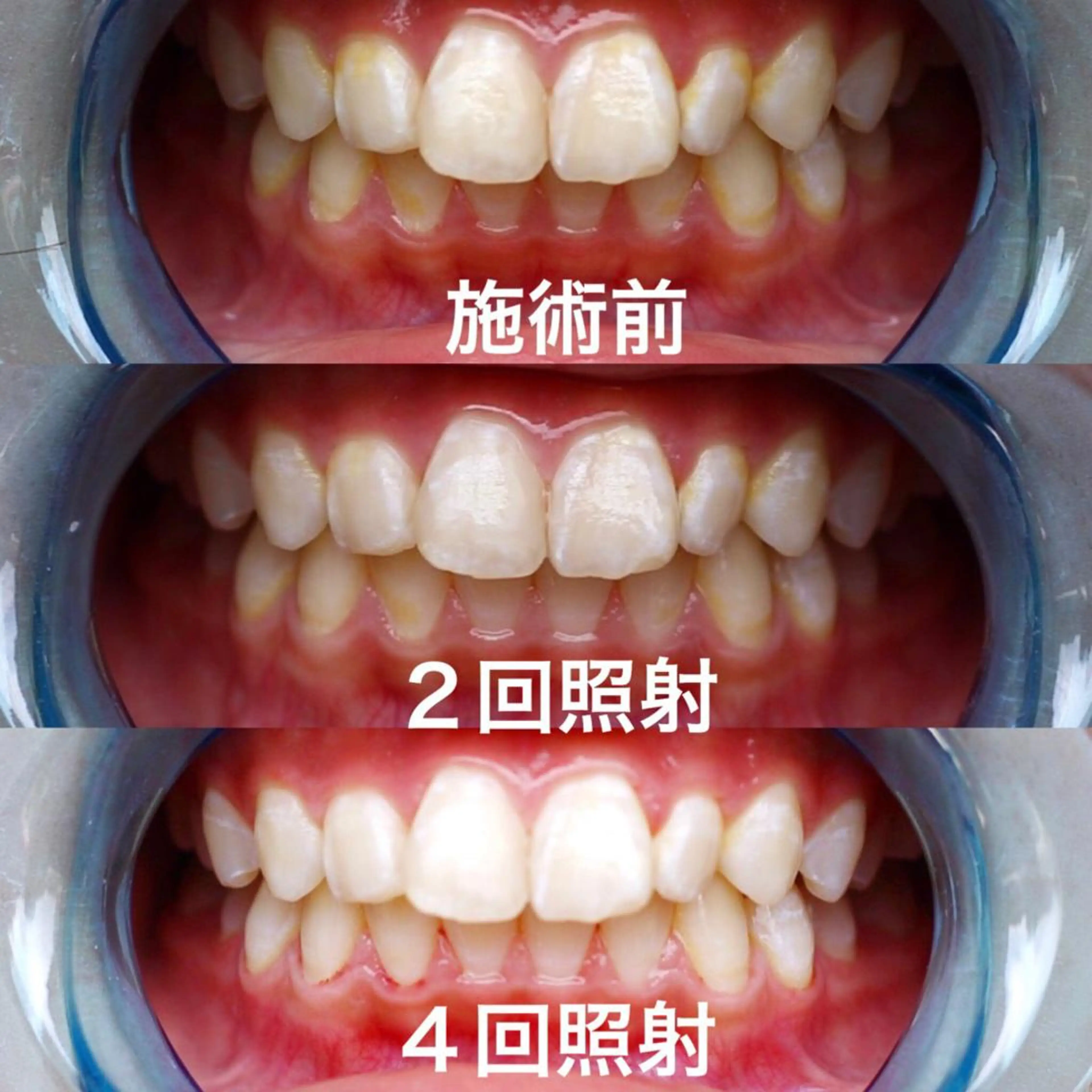 カラー その他 ホワイトニングテラス ティンクルのその他イメージ