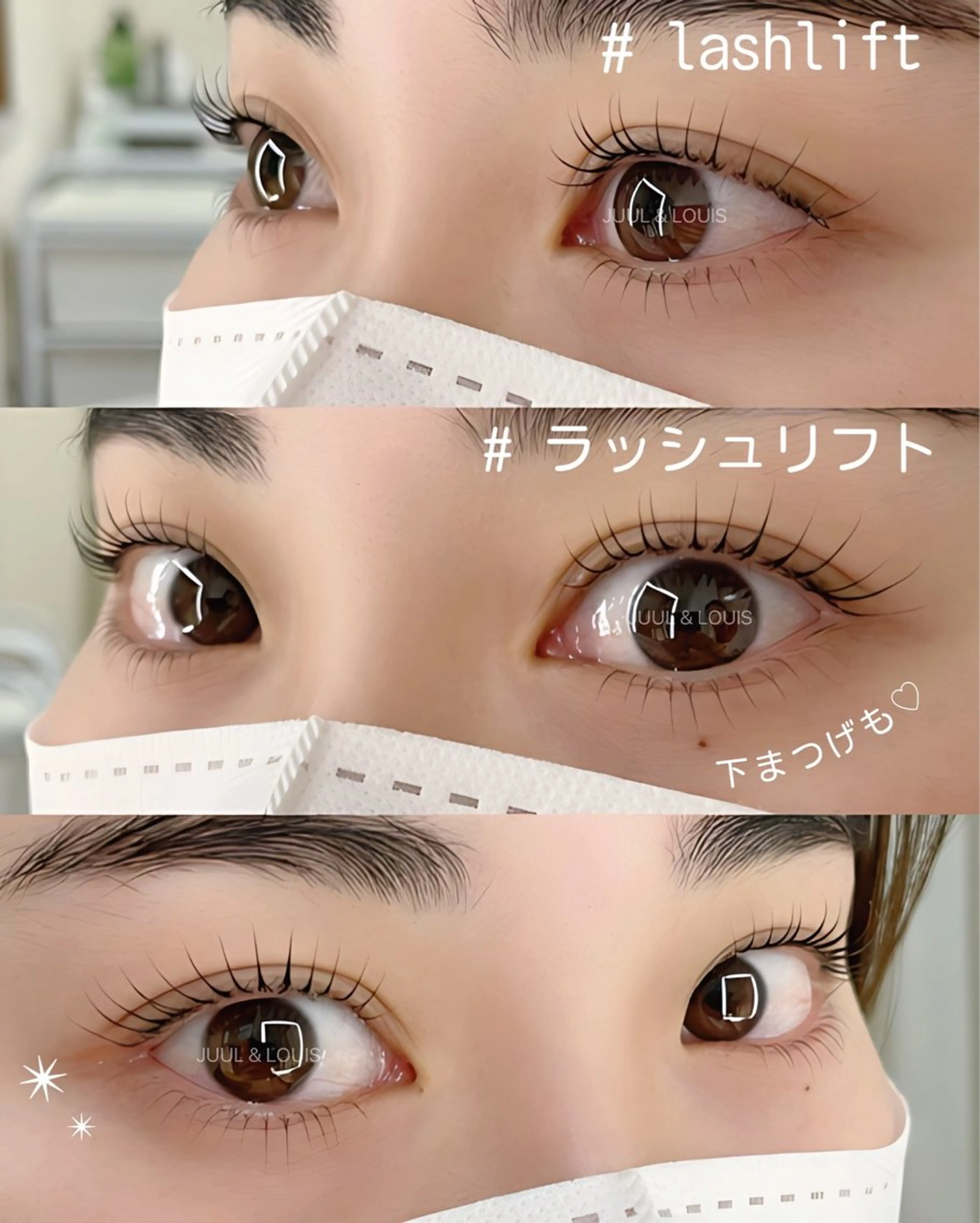 マツエク・マツパ まつげパーマ 下まつげエクステ まつげのお店 JUUL & LOUIS ｼﾞｭｰﾙｱﾝﾄﾞﾙｲｽ所属・JUUL&LOUIS 福藤 瞳のエステ・リラクイメージ