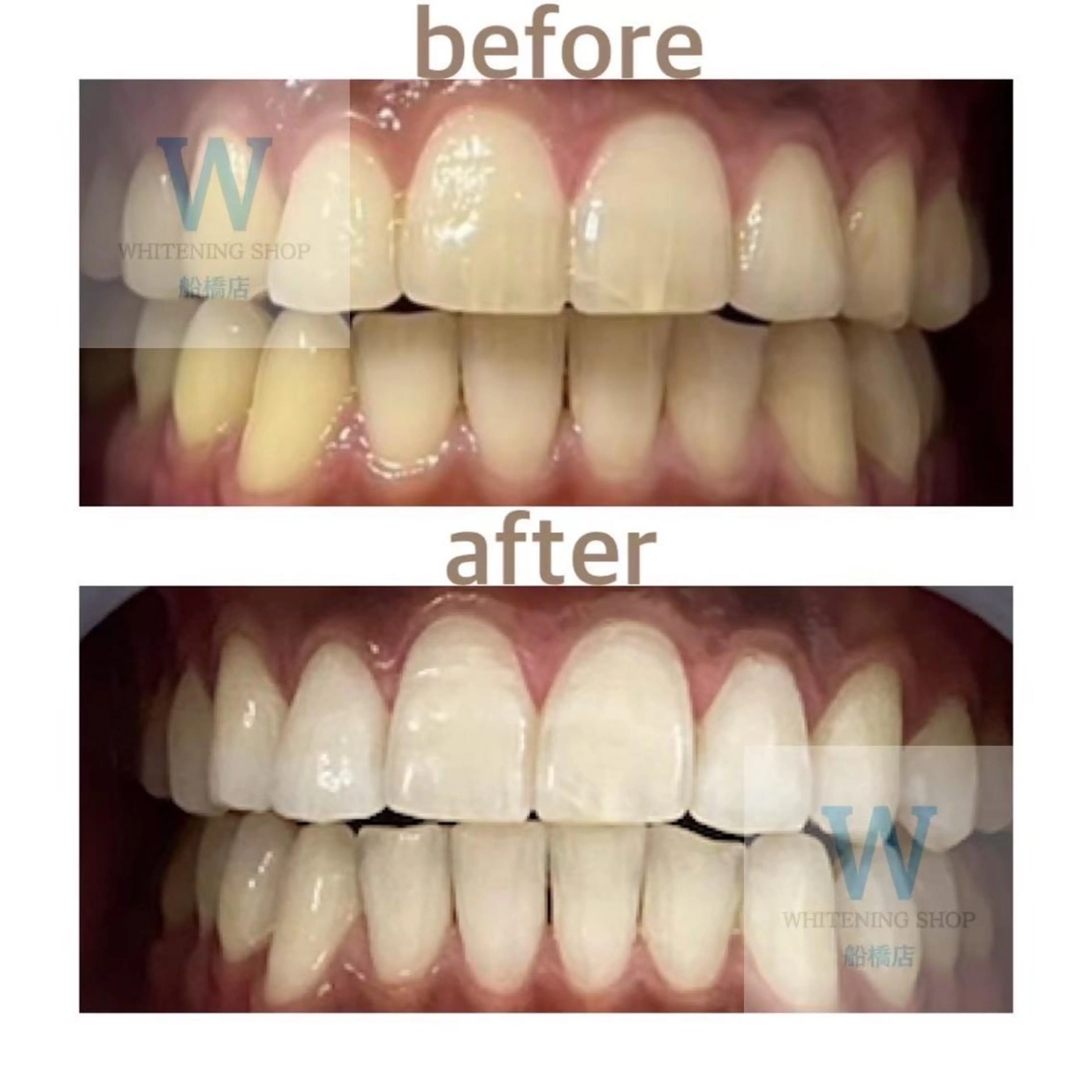 ホワイトニング ショップ船橋２号店のエステ・リラクイメージ