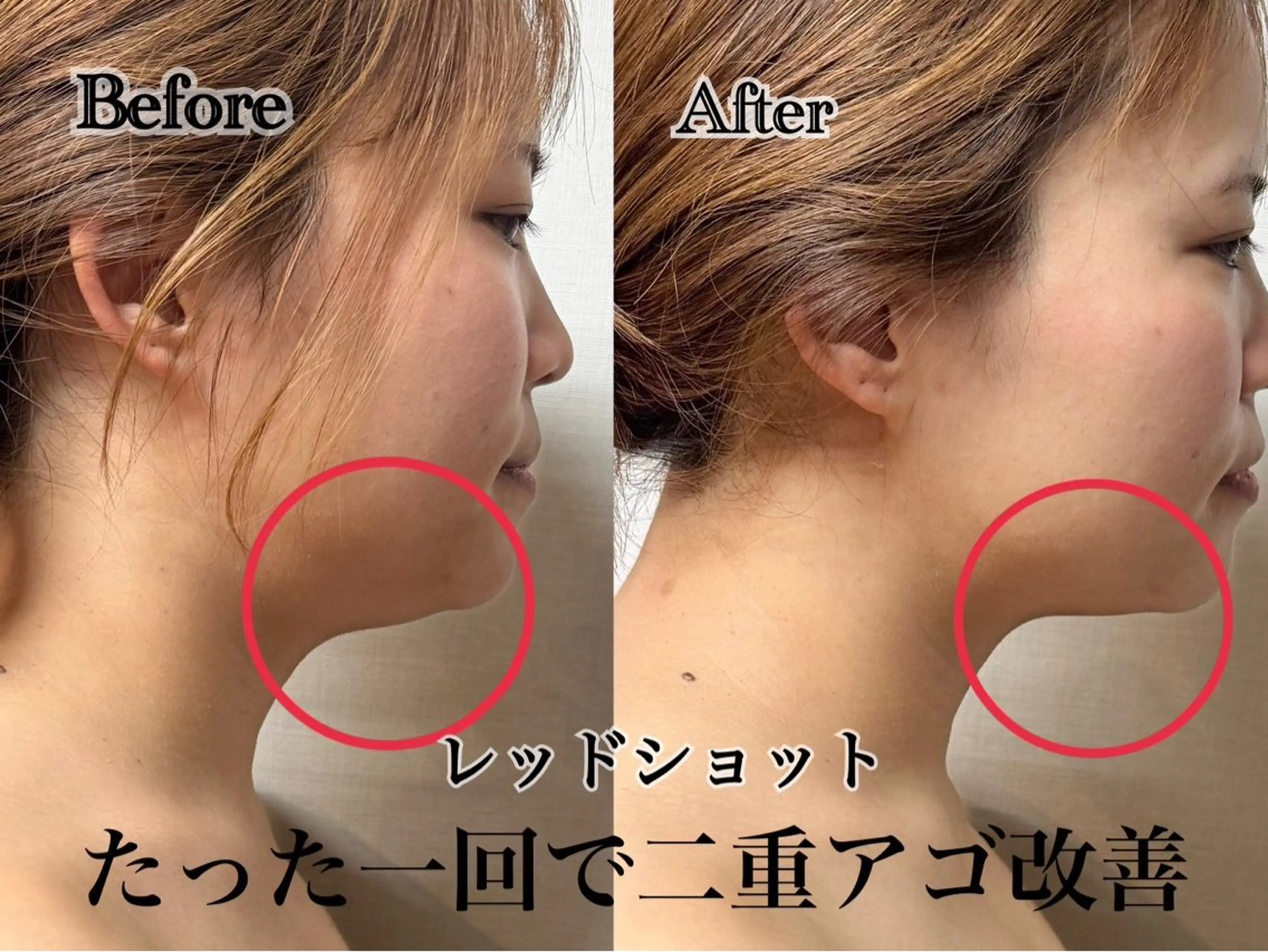 六本木脱毛andS さおりのエステ・リラクイメージ