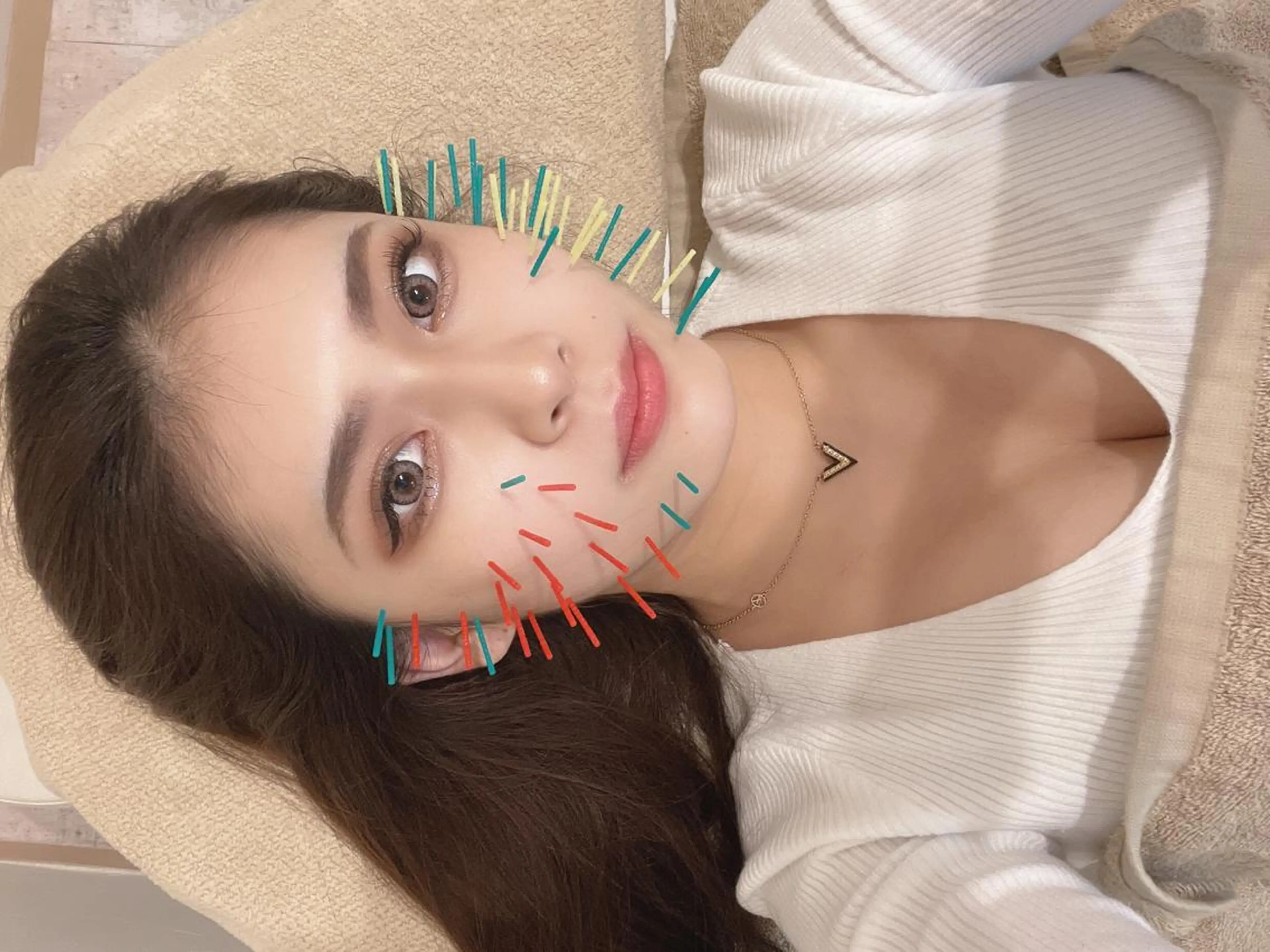 鍼灸整骨院Refine所属・鍼灸 Refineのその他イメージ