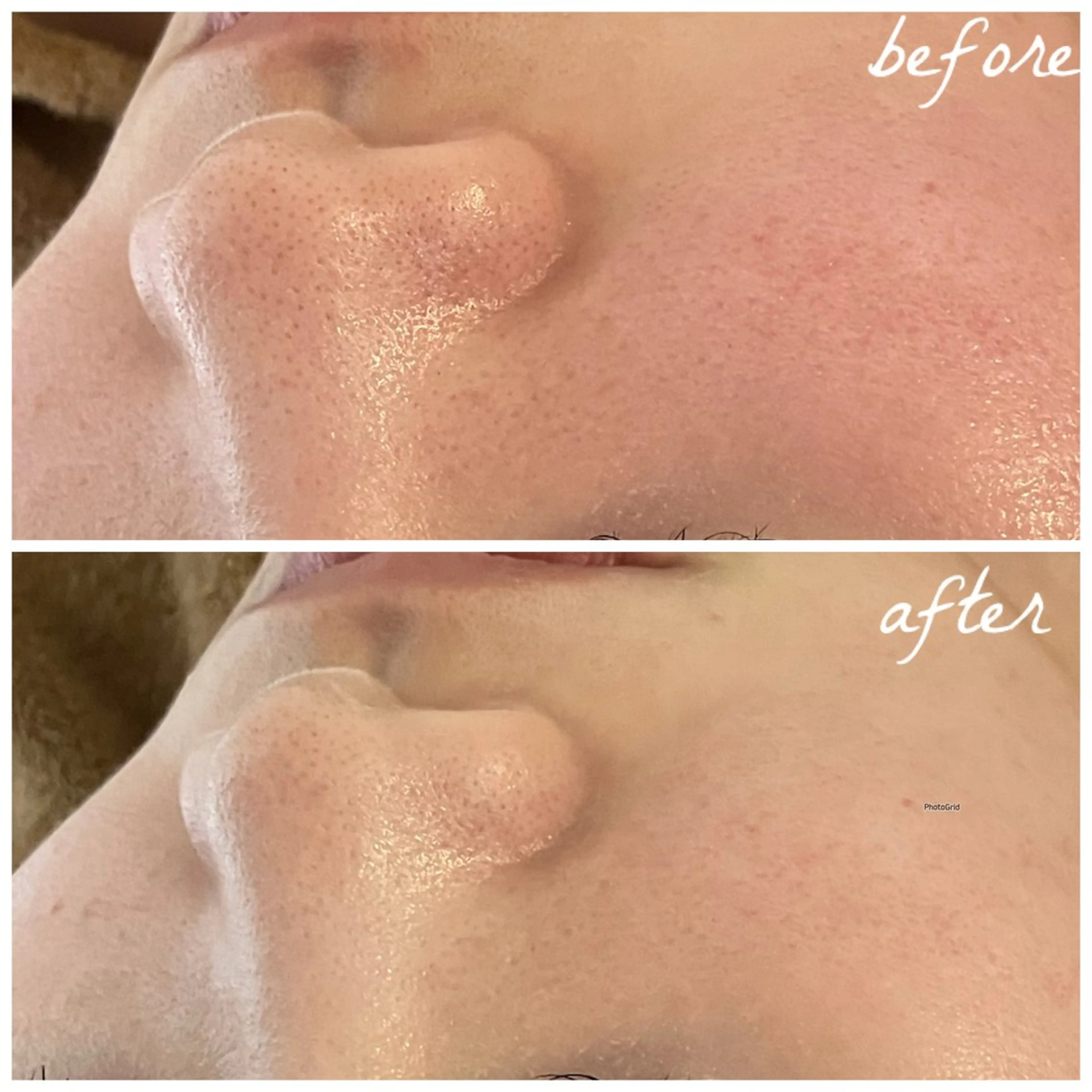 メンズ エステ メナード岐阜茜部 杉浦のエステ・リラクイメージ