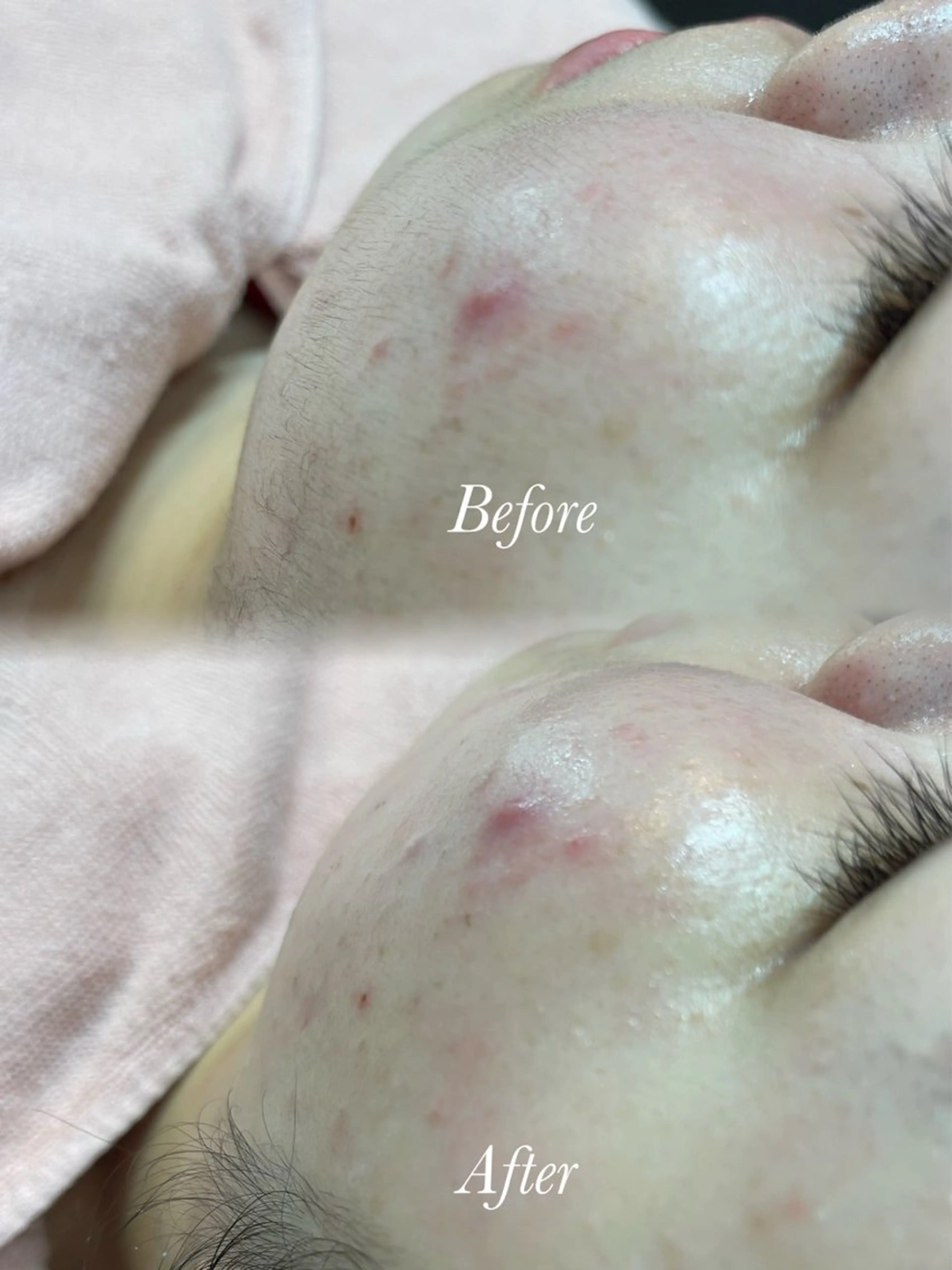 その他 🫧美しい素肌へ🫧 今成柚乃のその他イメージ