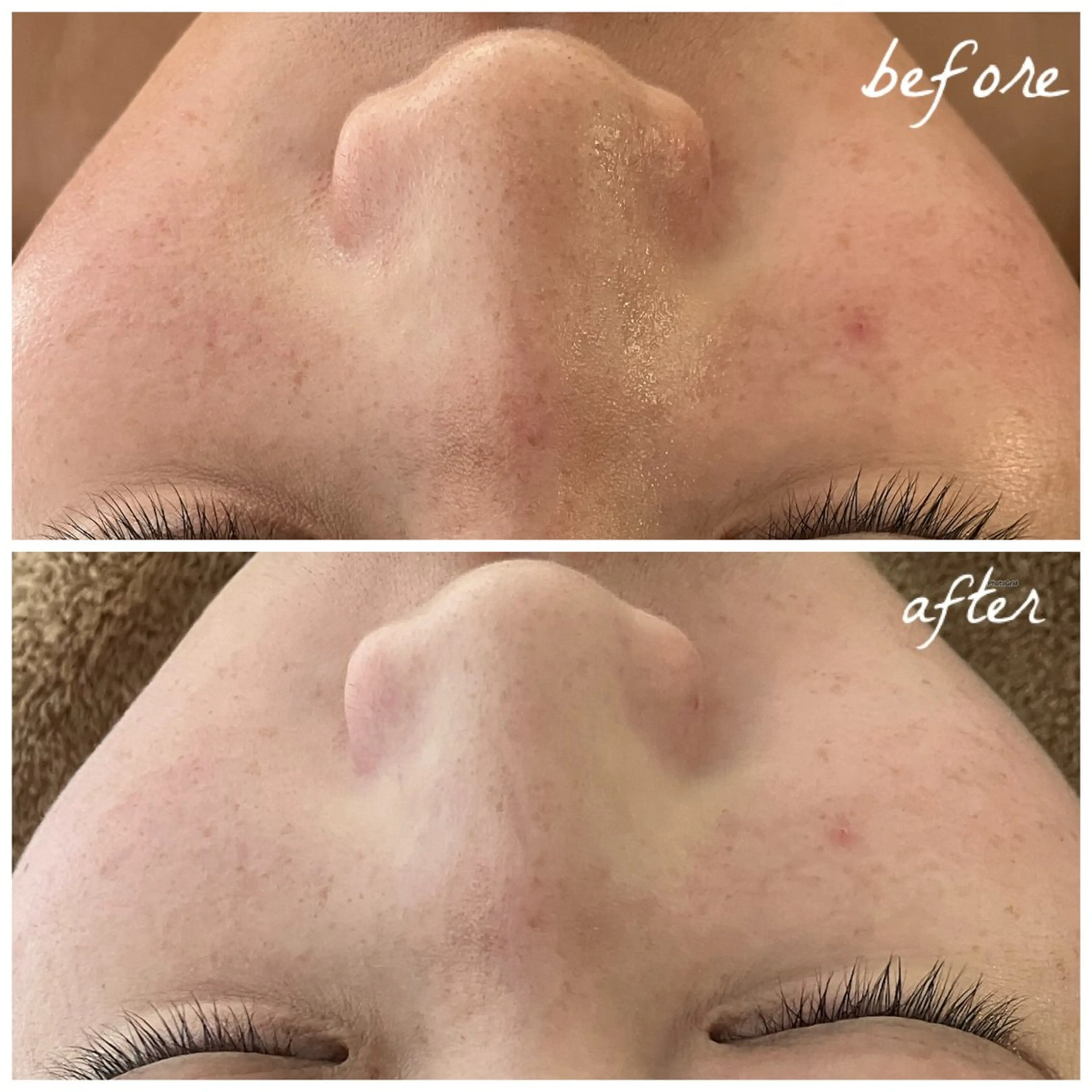 メンズ エステ メナード岐阜茜部 杉浦のエステ・リラクイメージ