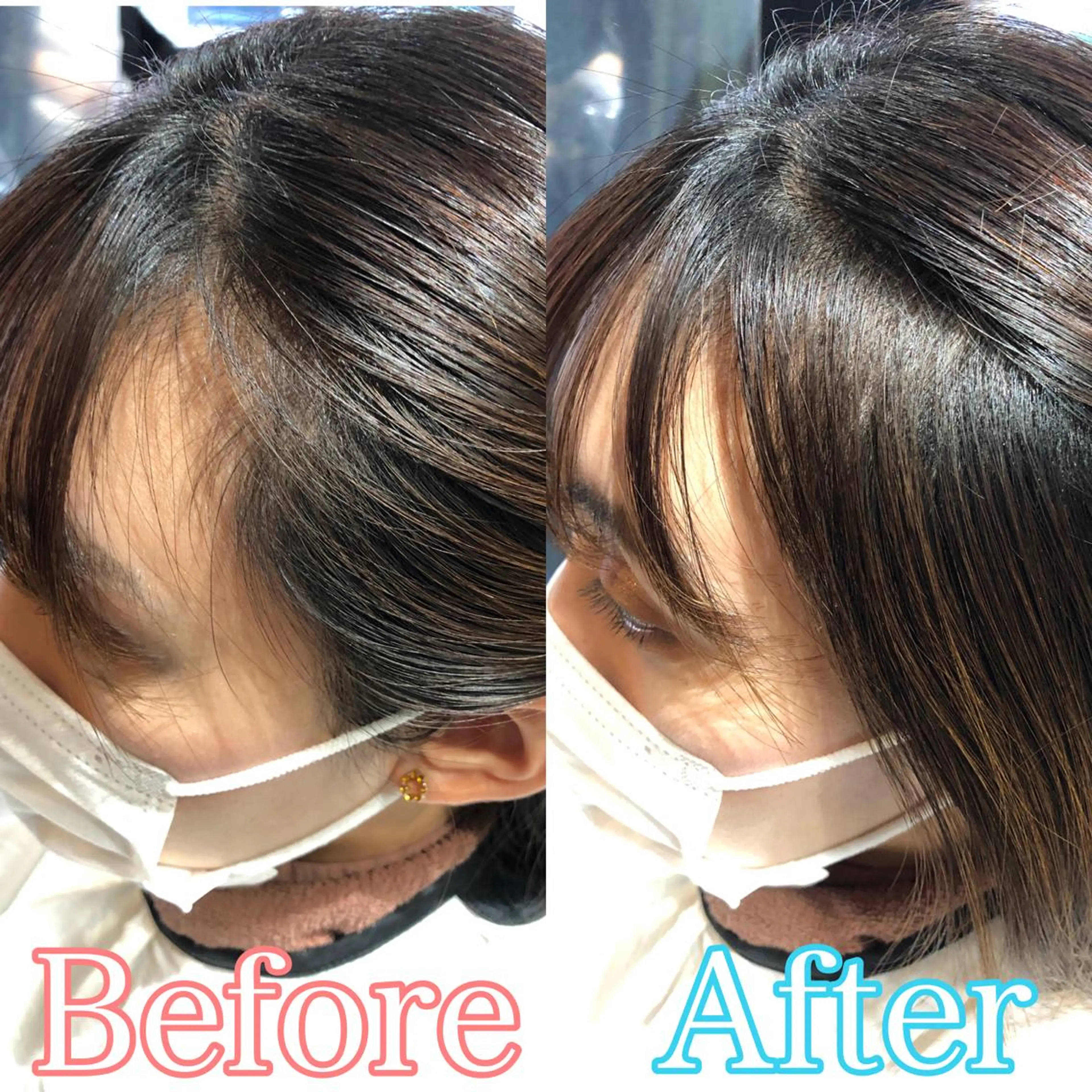 おでこやこめかみのすきまが気になる方に✨前髪カット＋うぶ毛カットの写真