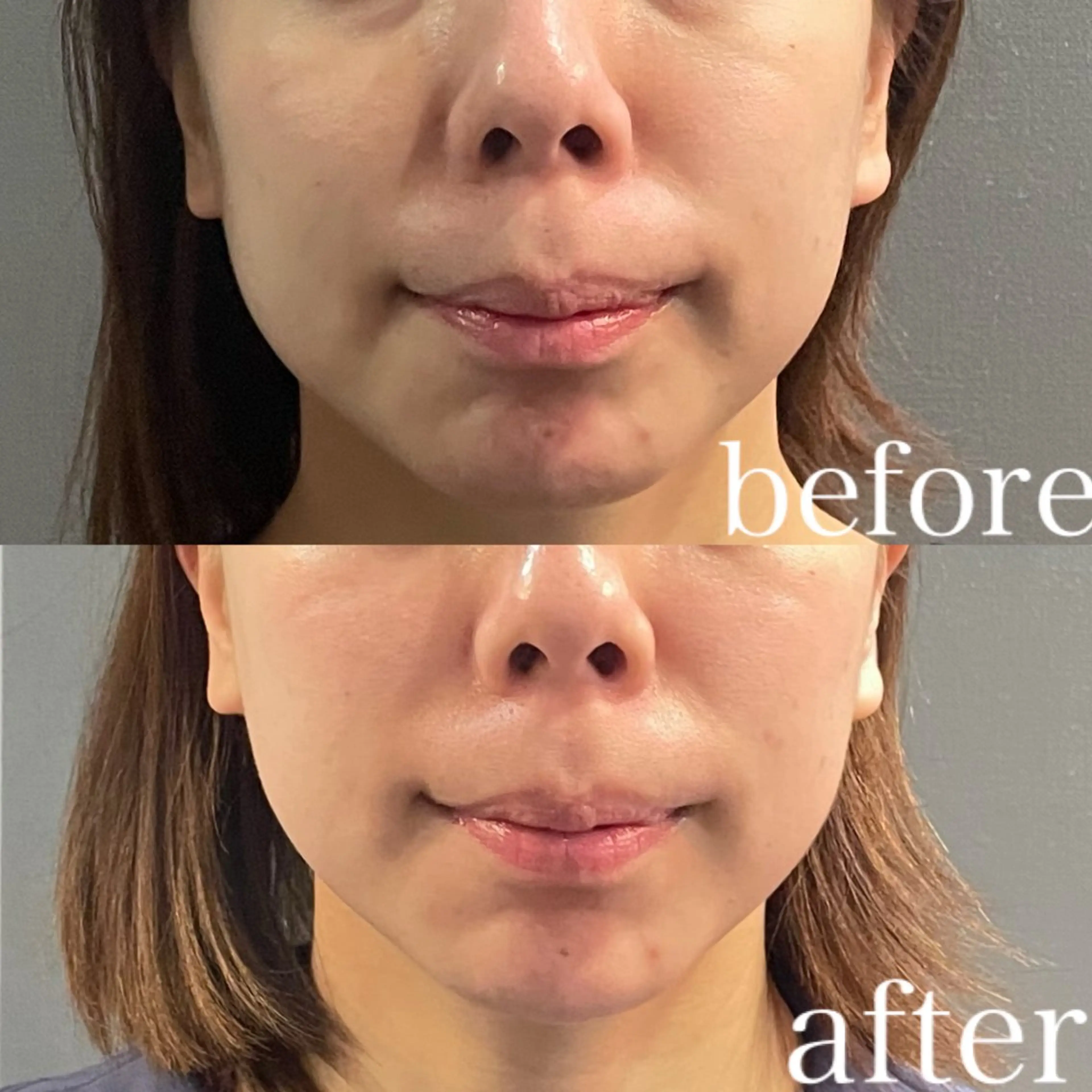 骨気&Relaxation vivian所属・VIVIAN 前田のエステ・リラクイメージ